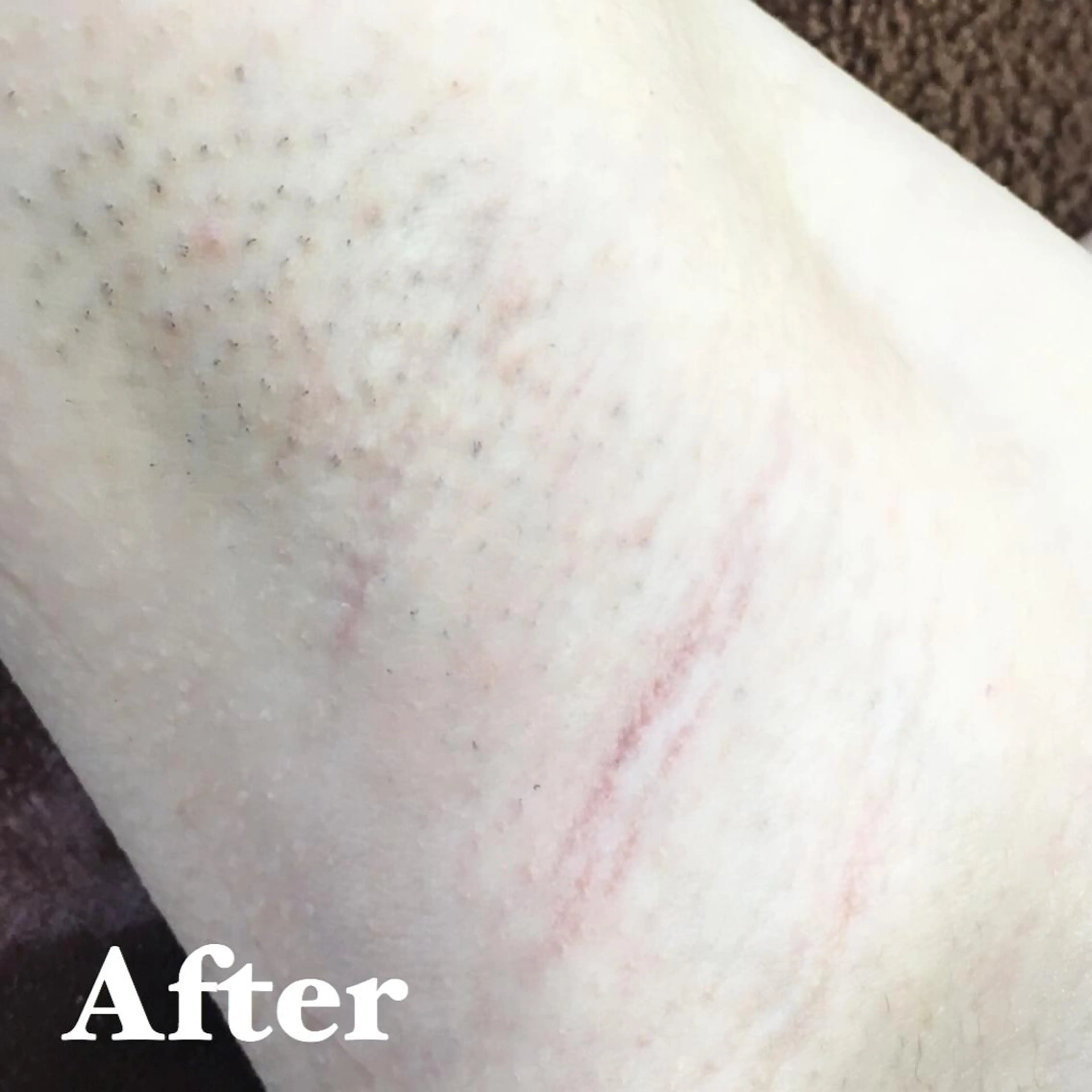 MIMI 吉祥寺本店のエステ・リラクイメージ