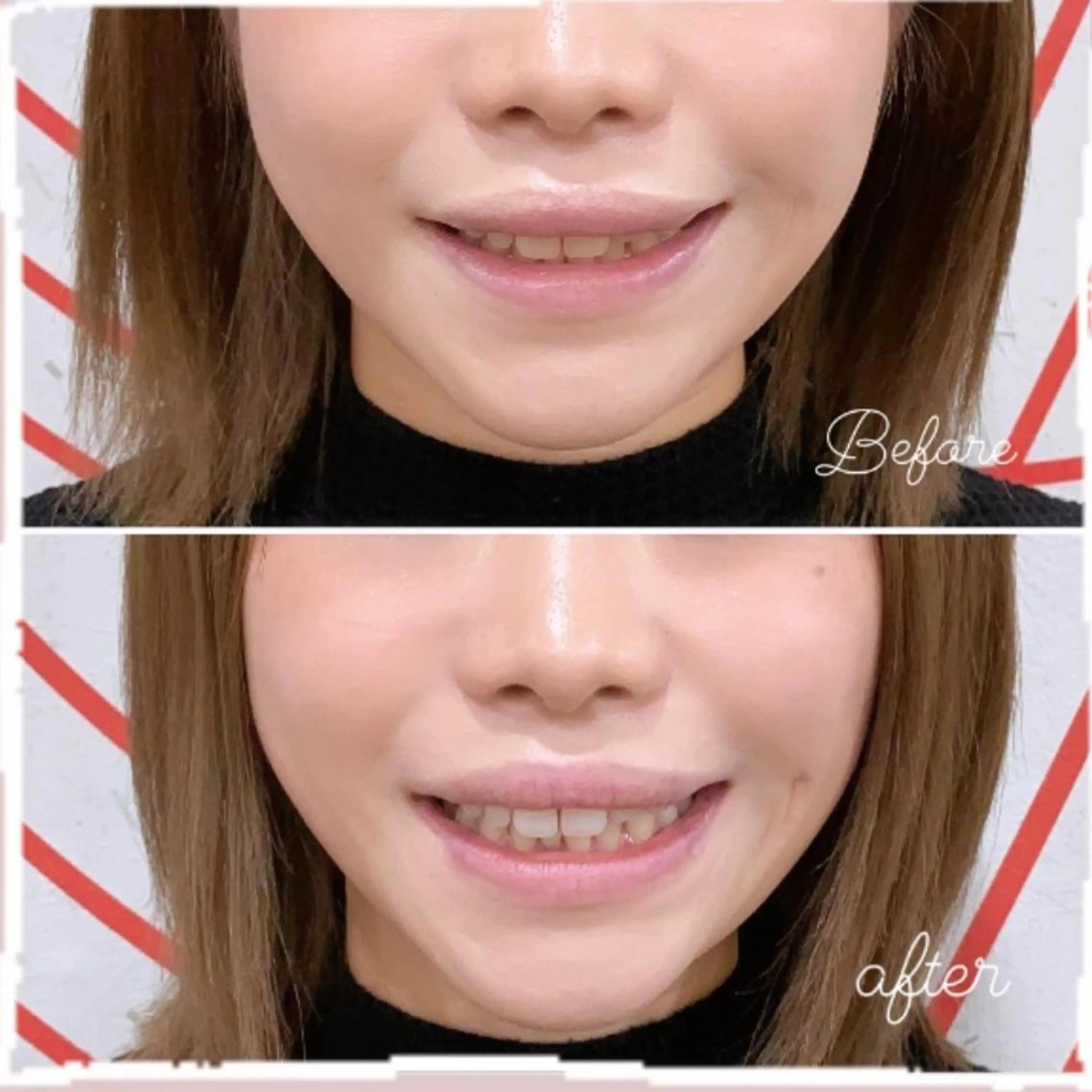 その他 whiteclub THREEのその他イメージ