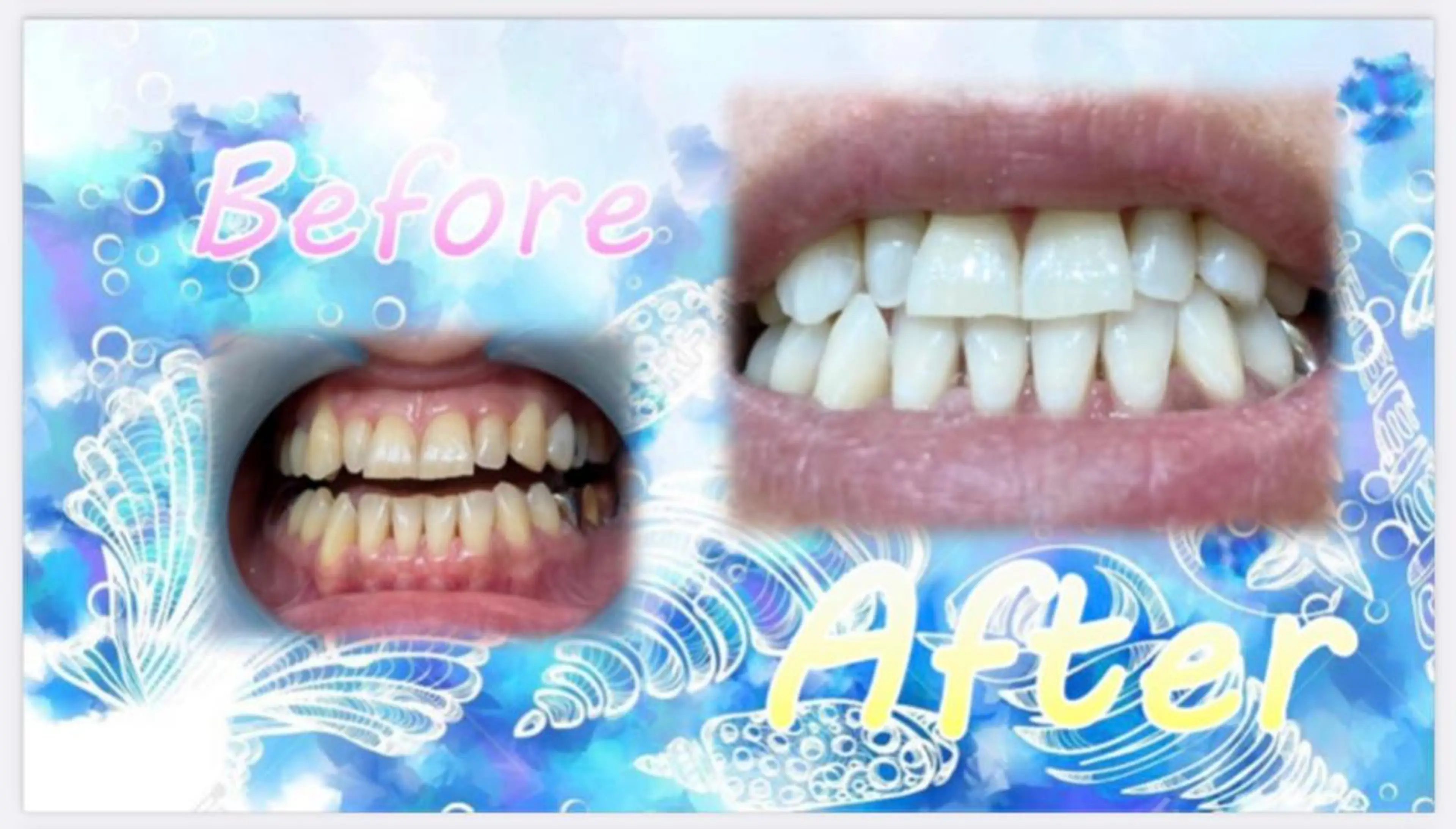 その他 セルフホワイトニングサロン　ラヴィアン所属・ホワイトニングサロン La vie enのその他イメージ