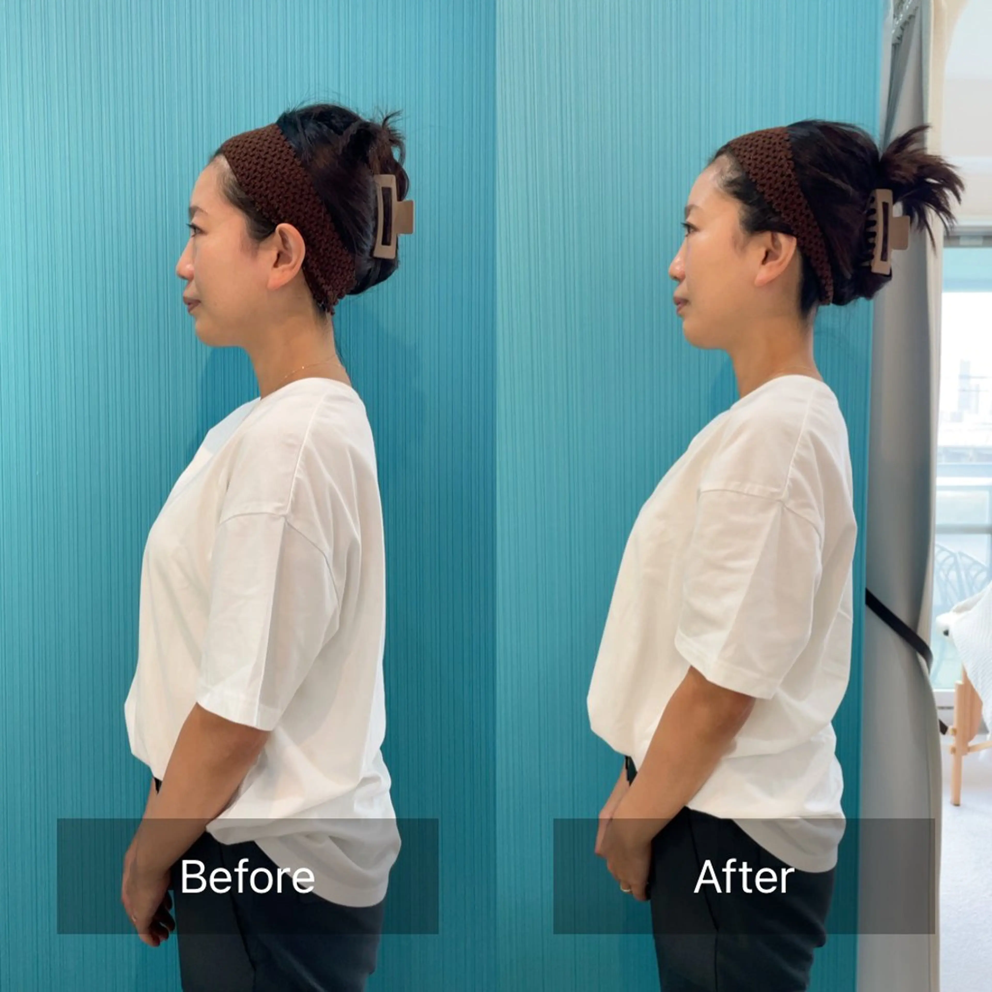 エステ リラク 肌質改善/エイジング 小顔/Kukunaのエステ・リラクイメージ