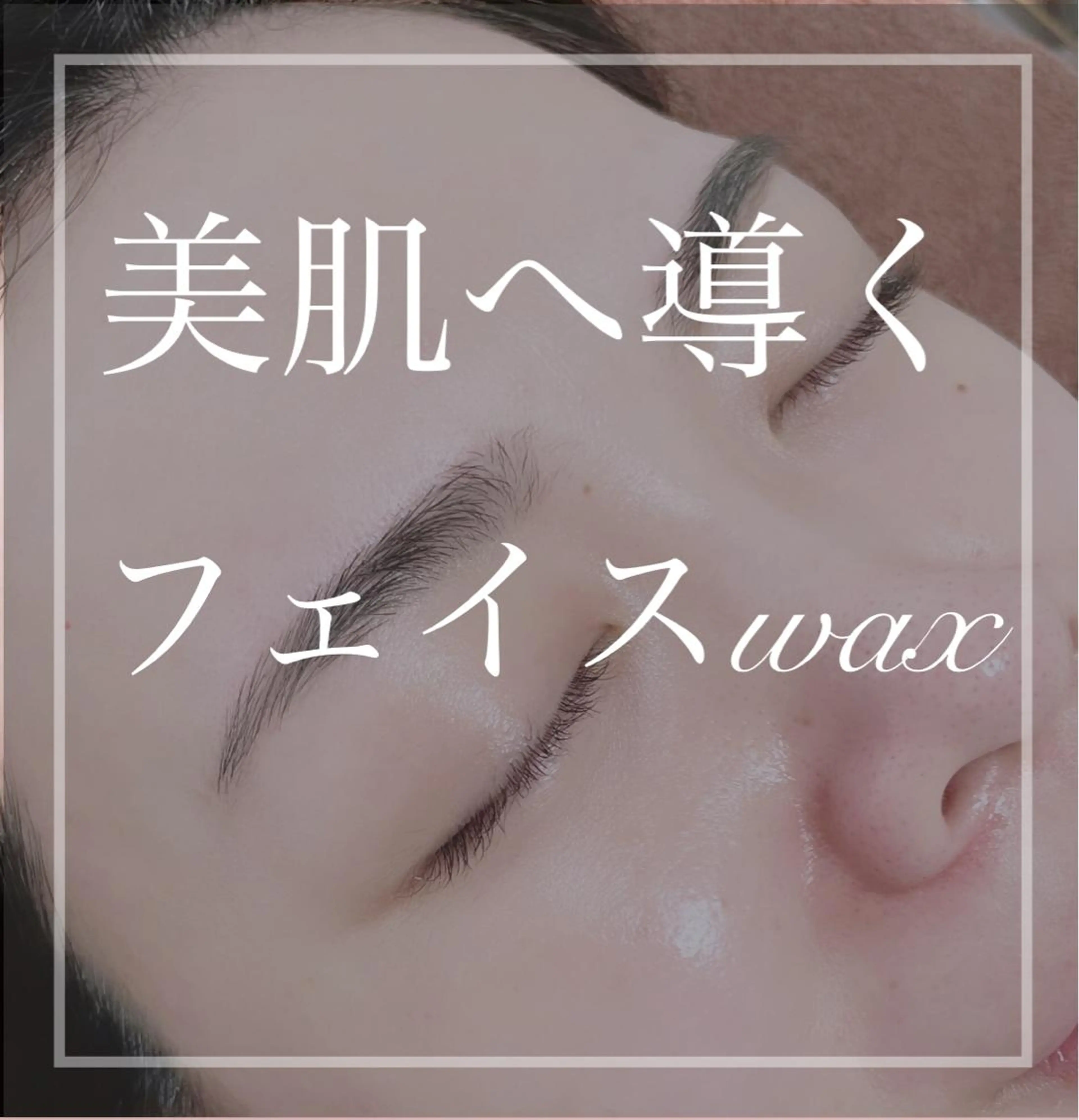 フェイスWax脱毛(1回) ※注意事項、掲載情報を必ず確認後ご予約くださいの写真