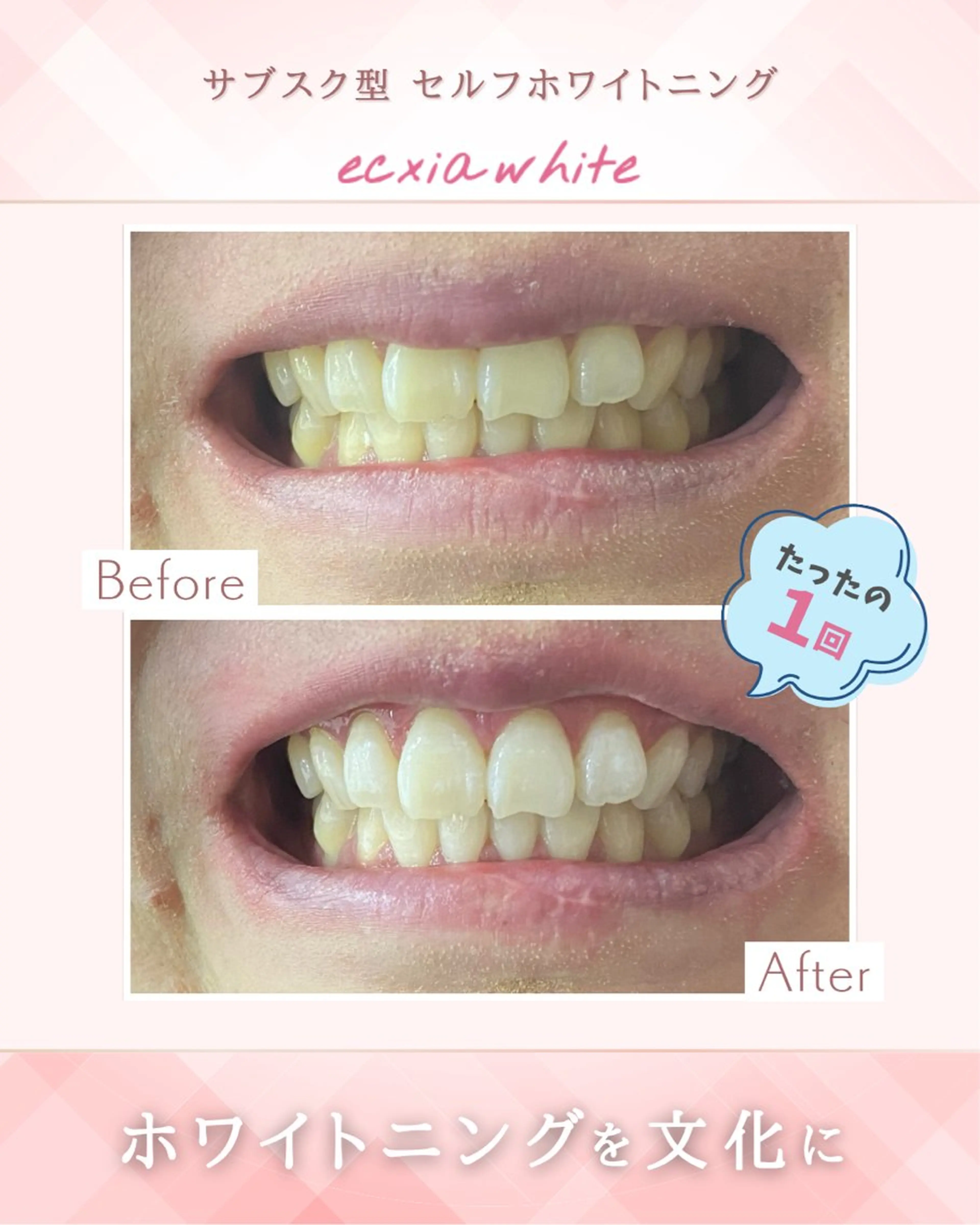 エクシアホワイト西尾 堀内恵のその他イメージ