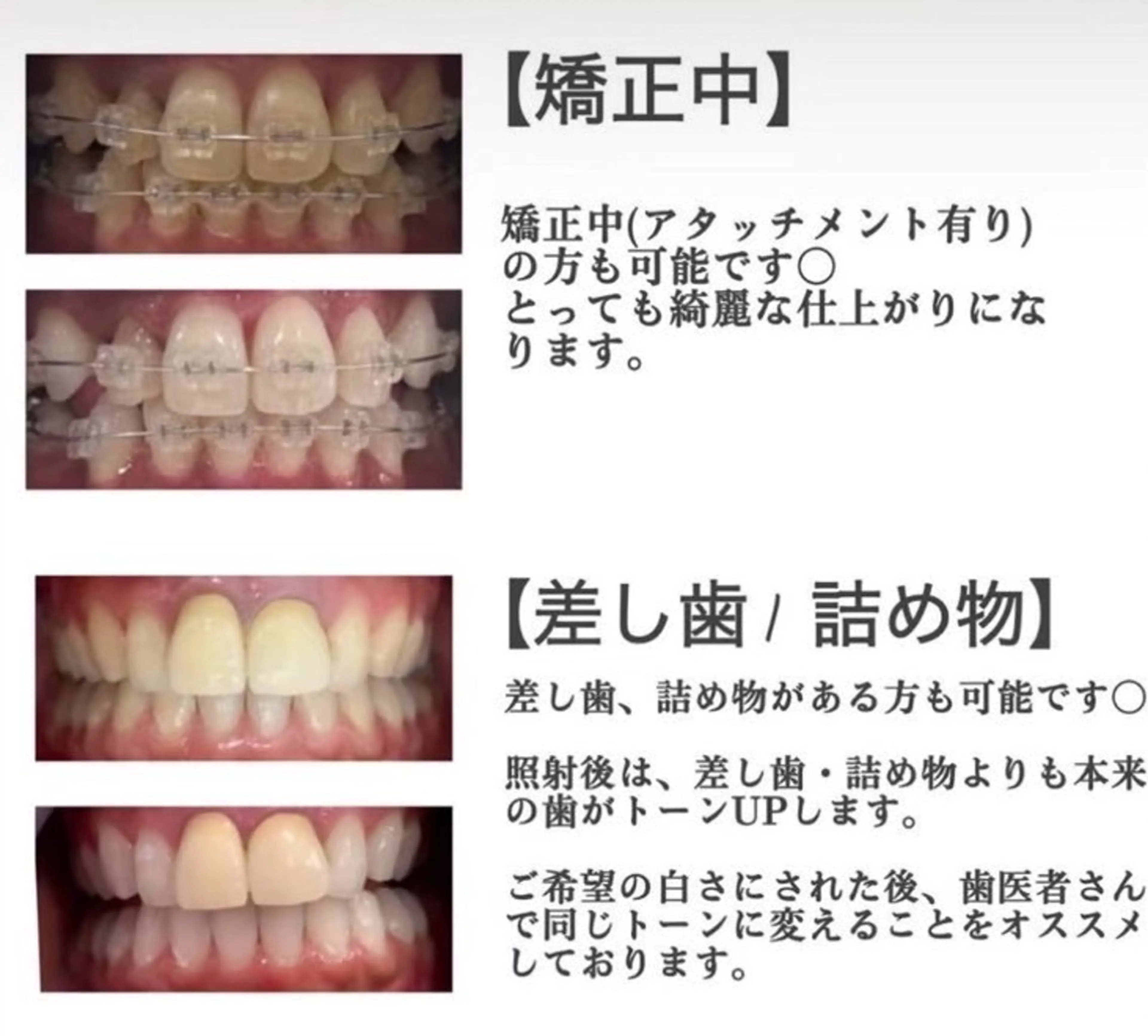 ホワイトニング ショップ伊丹店のその他イメージ