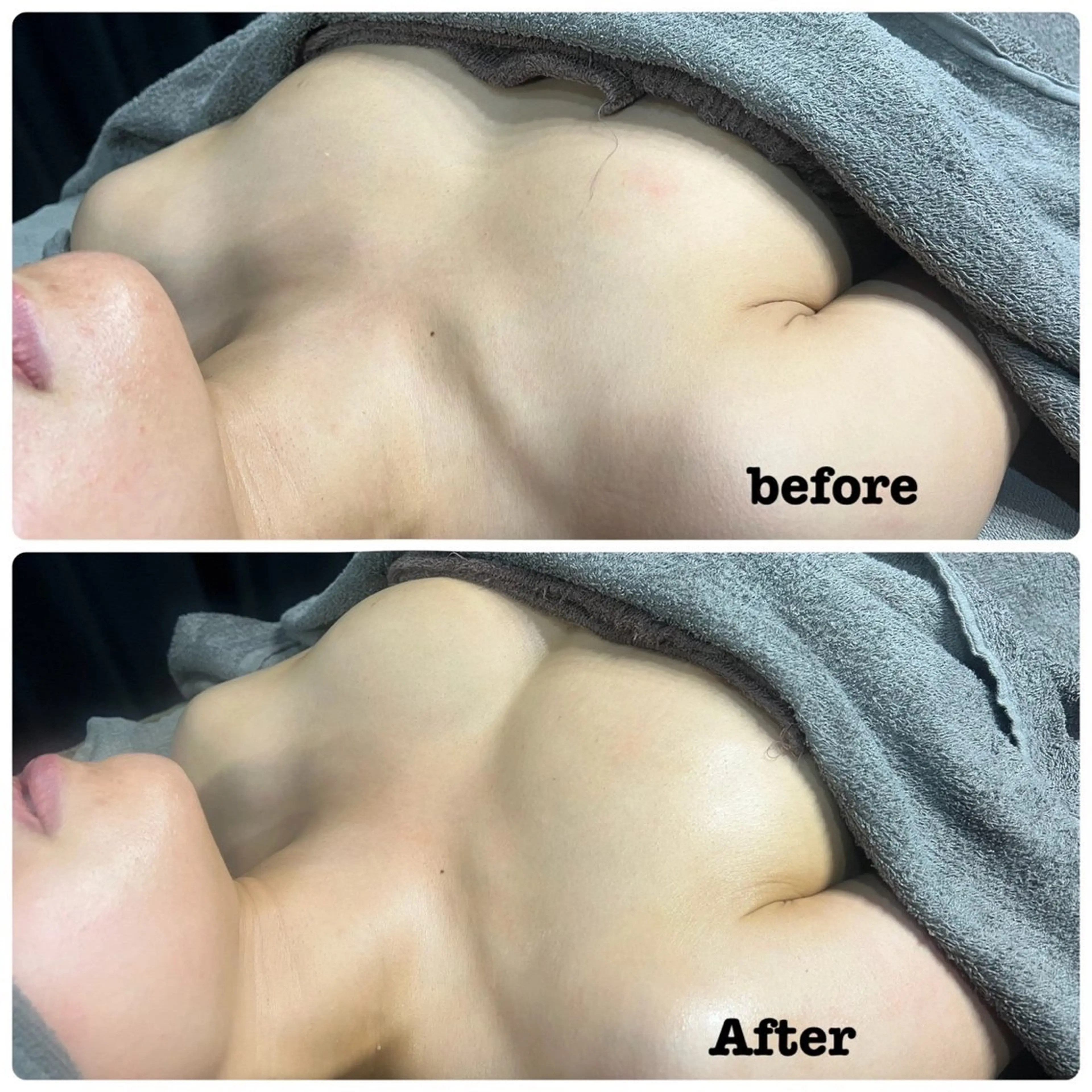 エステ Salon de CocoFranのその他イメージ