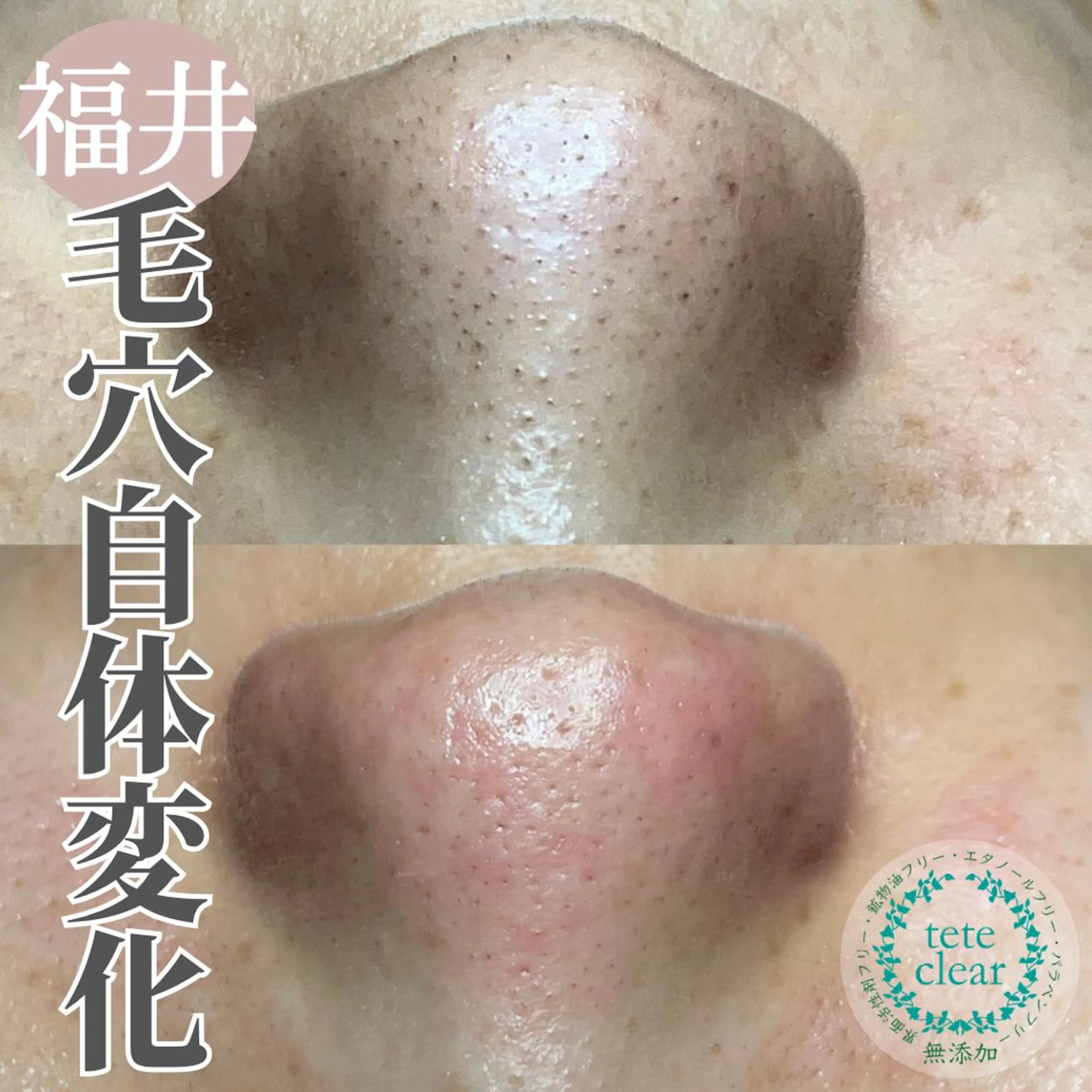 毛穴肌質ケアサロン Yourmeユアミーのエステ・リラクイメージ