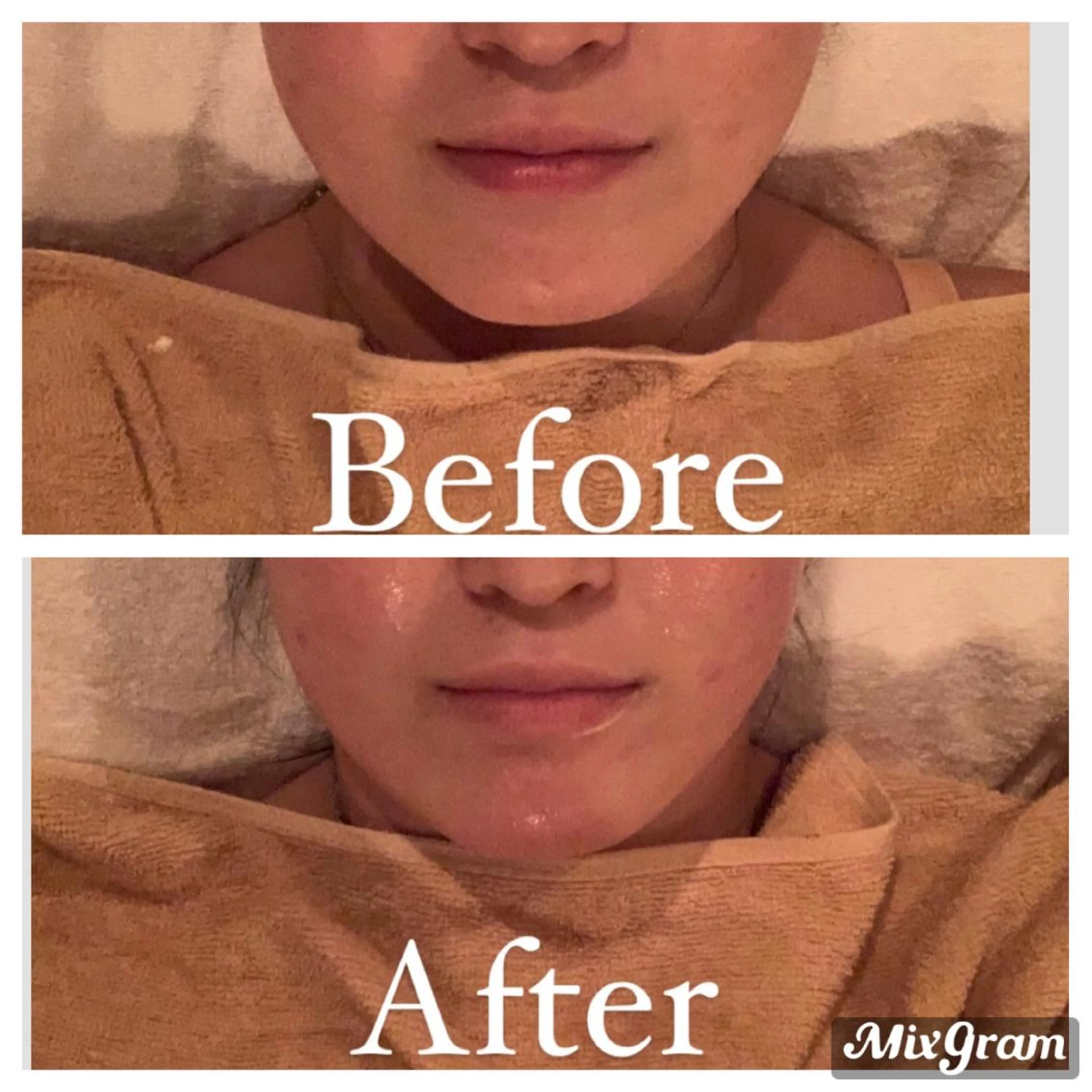 ワックス脱毛 ♡AYO♡のエステ・リラクイメージ