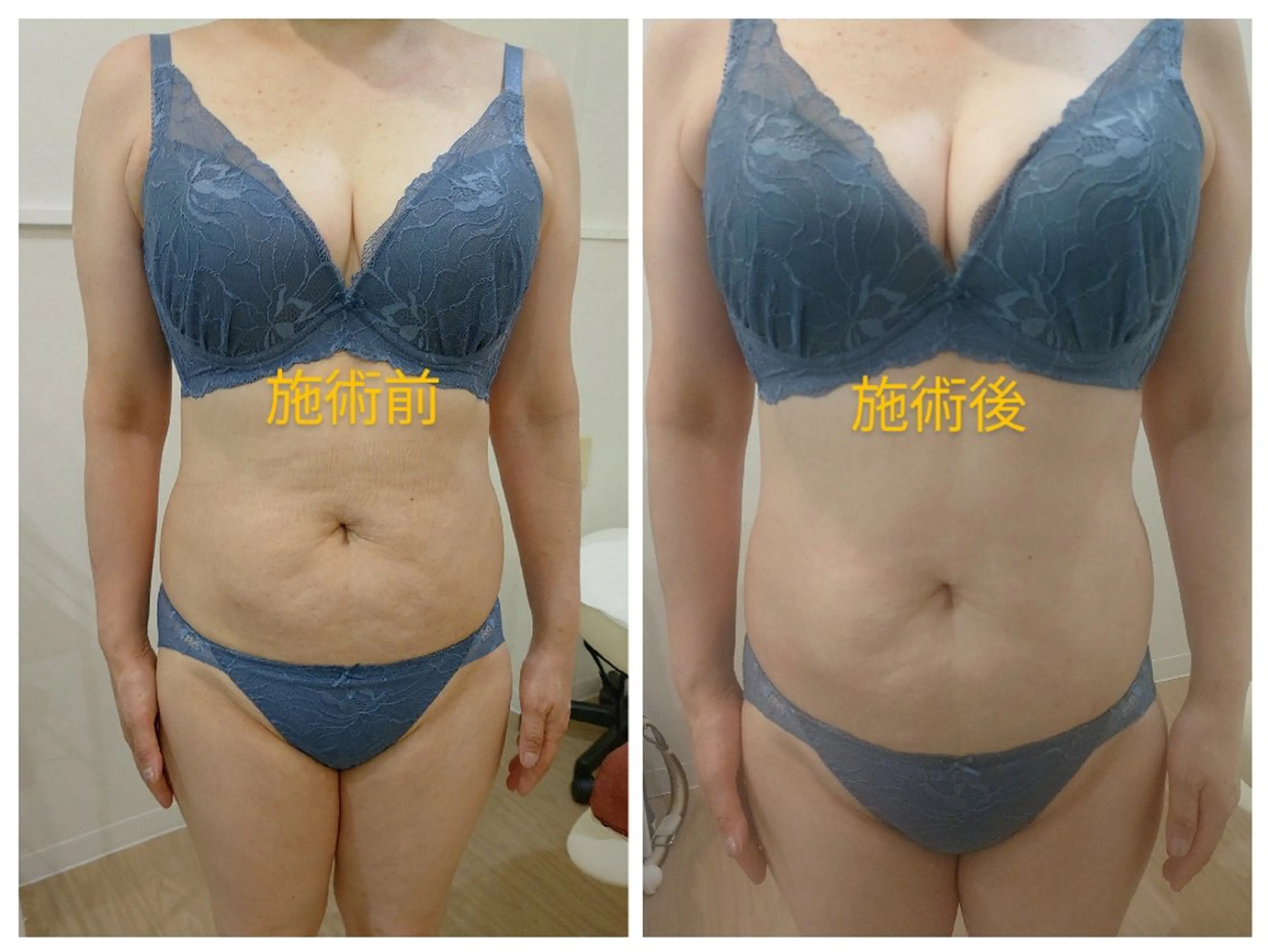 ☆リラックス☆ ジュリーのエステ・リラクイメージ