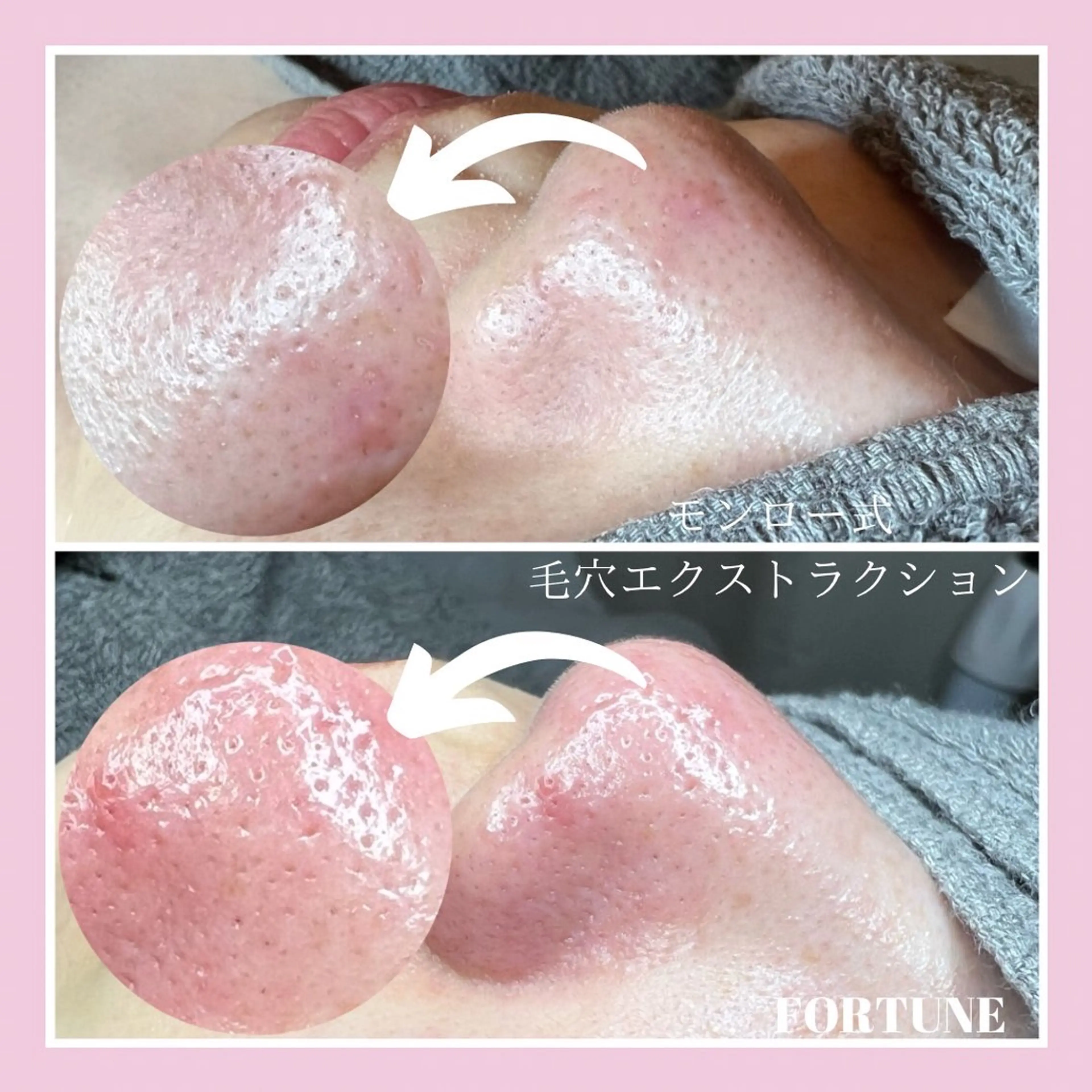 エステ fortune横浜 天王町のその他イメージ