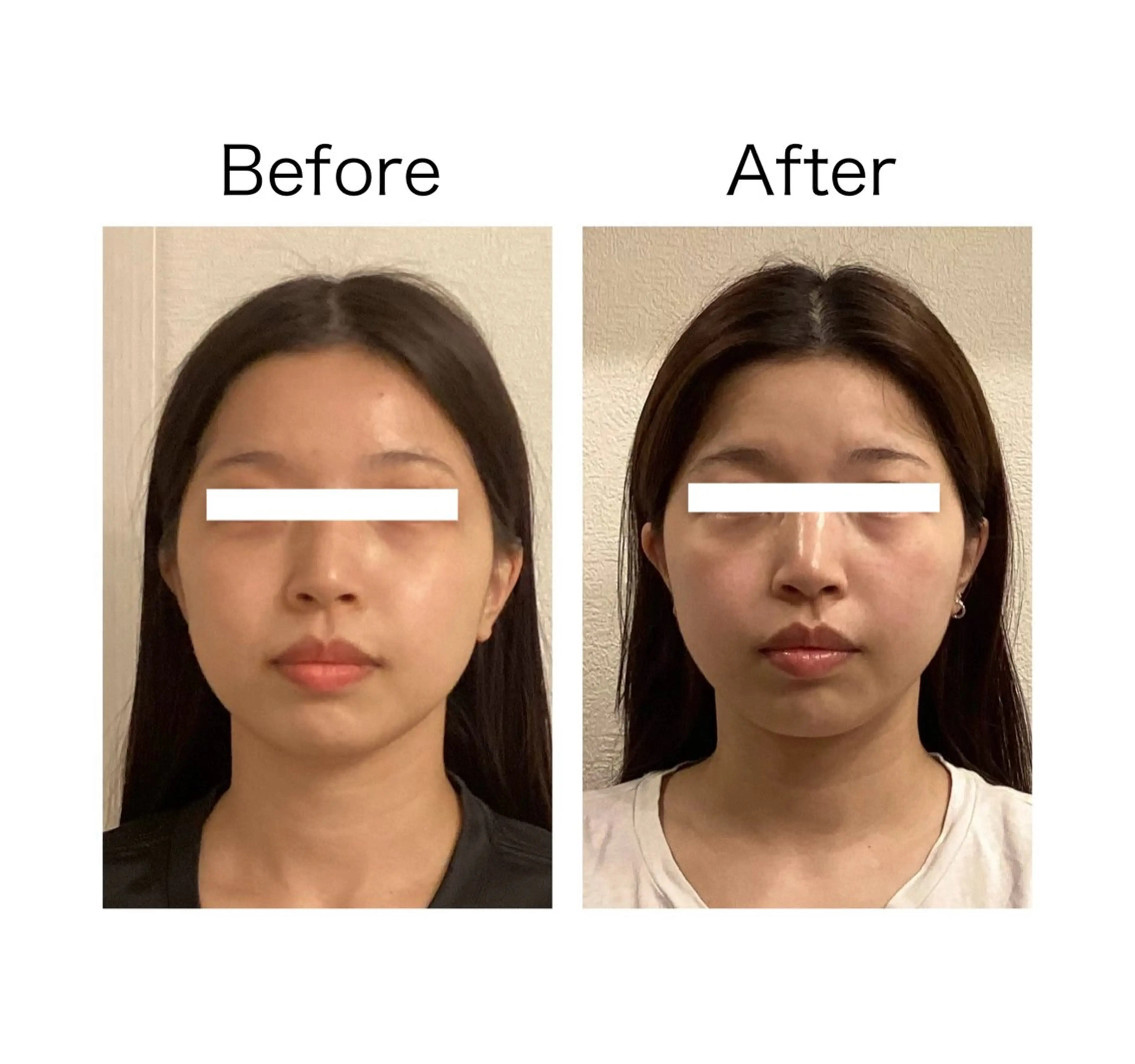 エステ 小顔サロン sharpのエステ・リラクイメージ