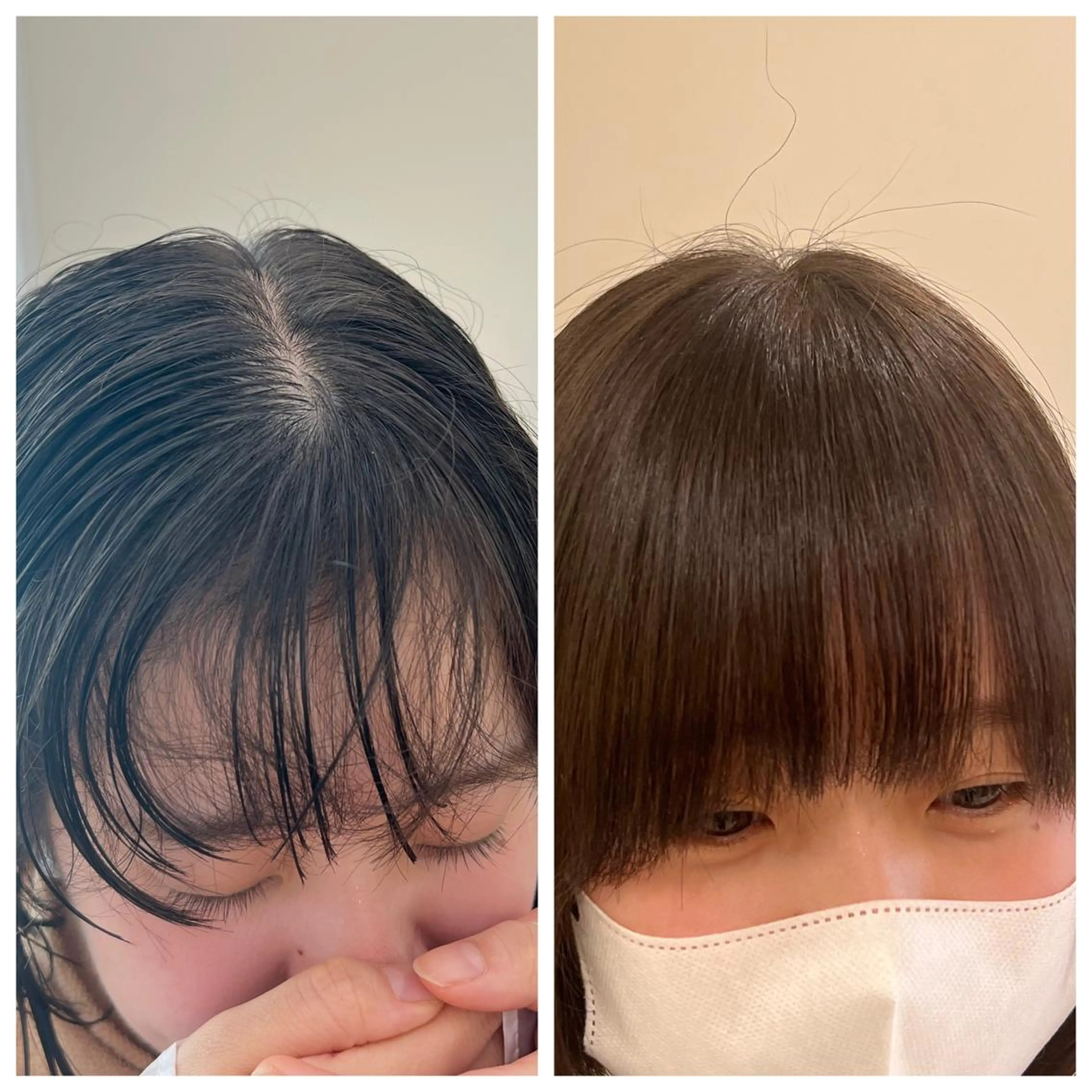 ミディアム カット 縮毛矯正 🐋湊 ゆうき 🫧のヘアスタイル