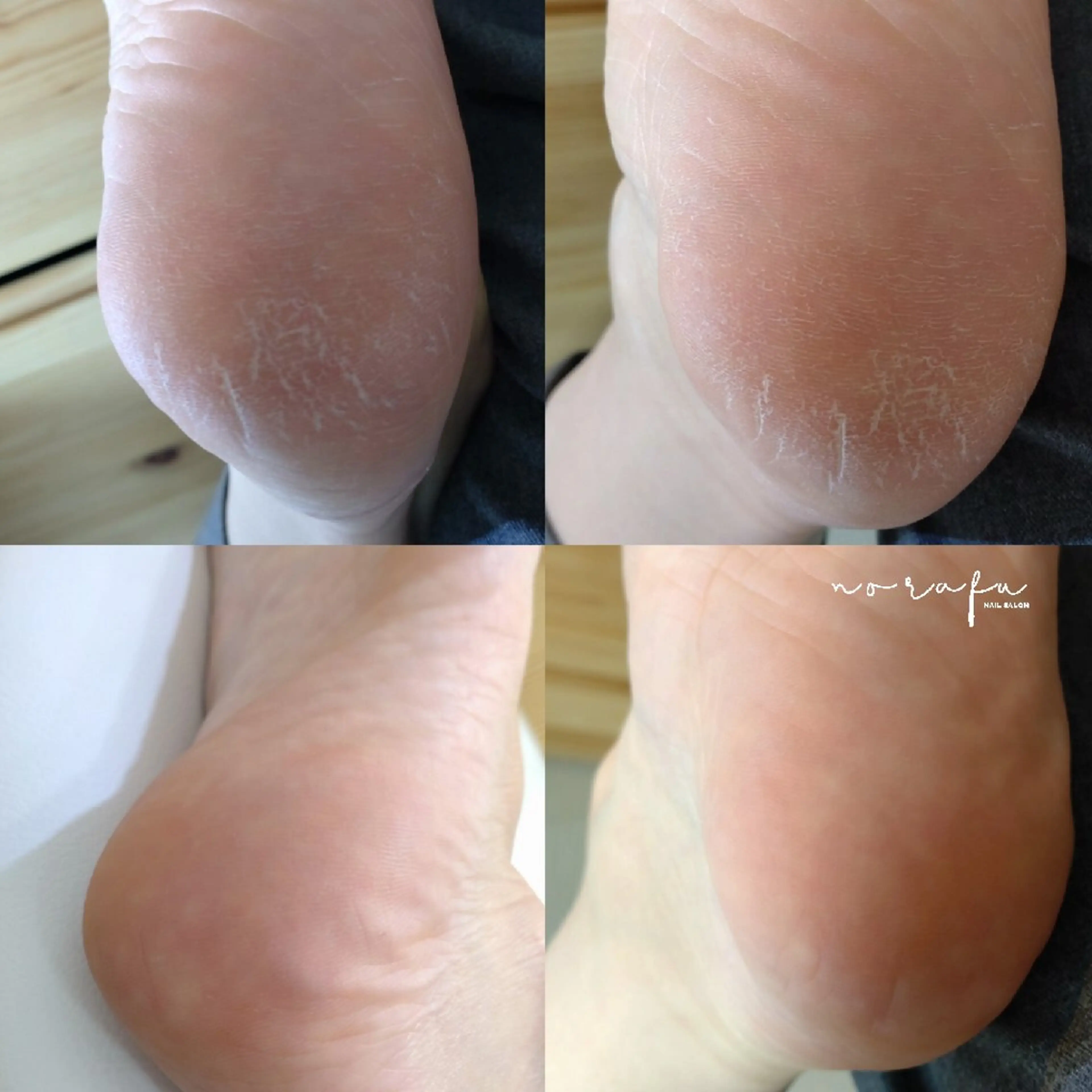 ネイル フットネイル nail 　norafu.のネイルデザイン