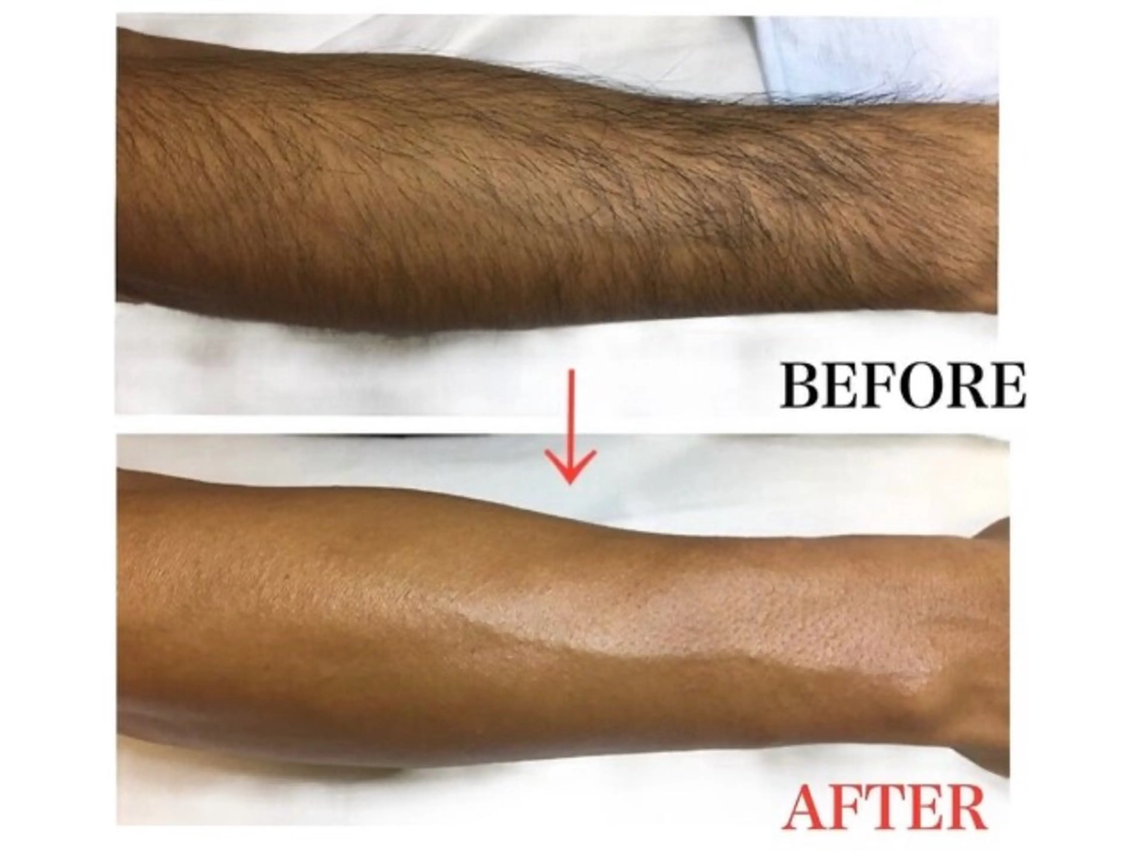 メンズ 脱毛 メンズ・ブリリアンス メンズ専用脱毛サロンのエステ・リラクイメージ