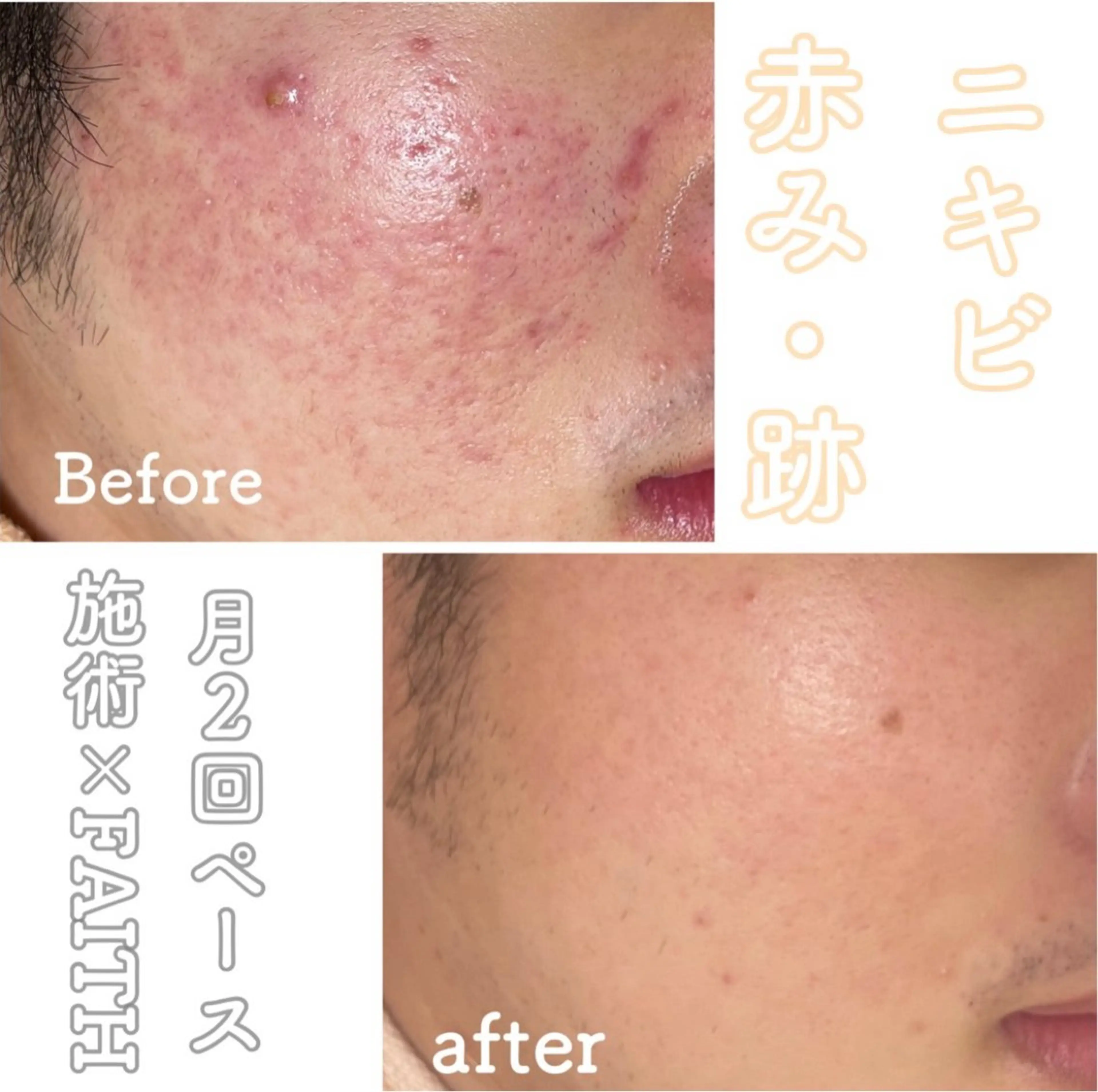 都度払い肌改善専門店 店長二上文香のエステ・リラクイメージ