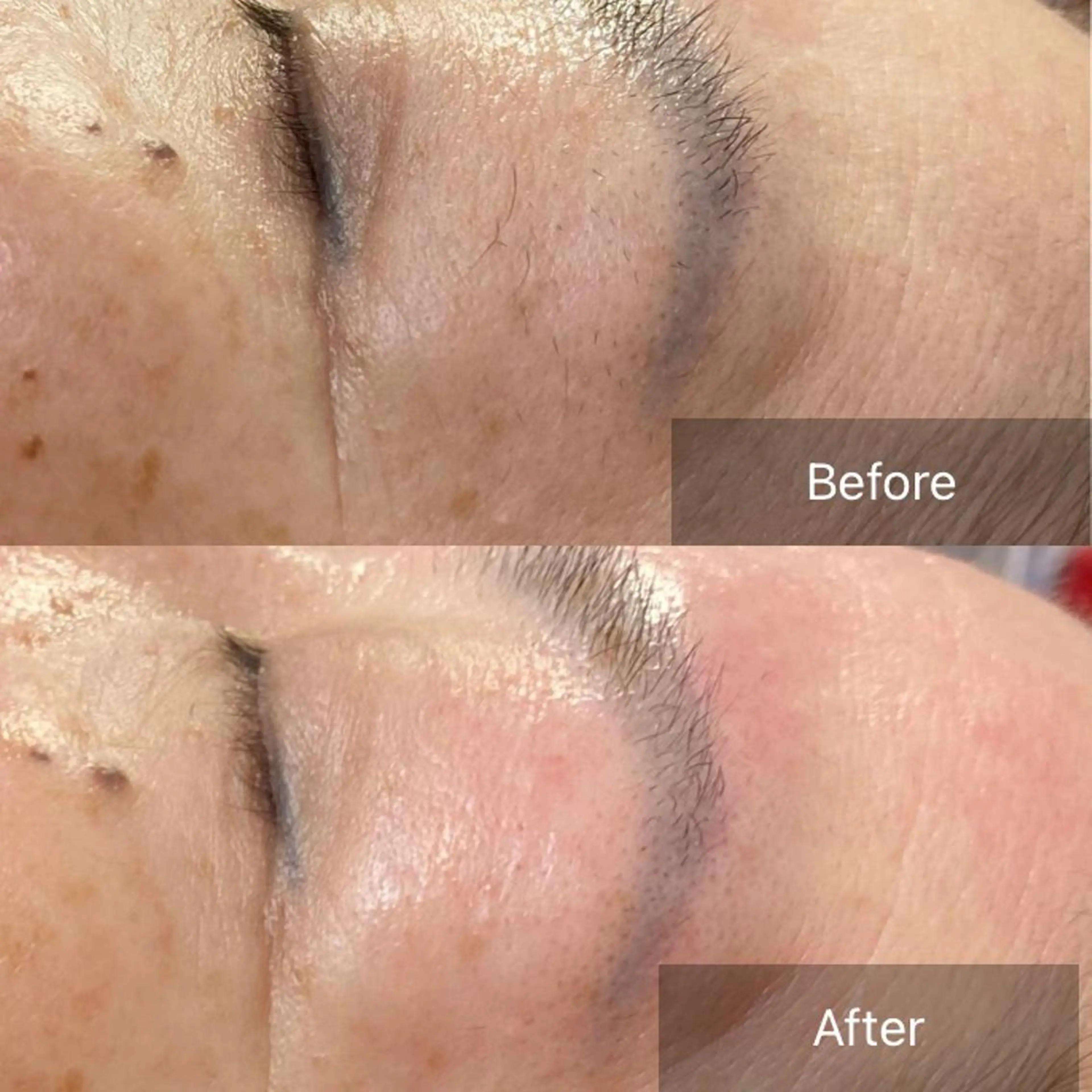 エステ 産毛専門店 Bittoのエステ・リラクイメージ