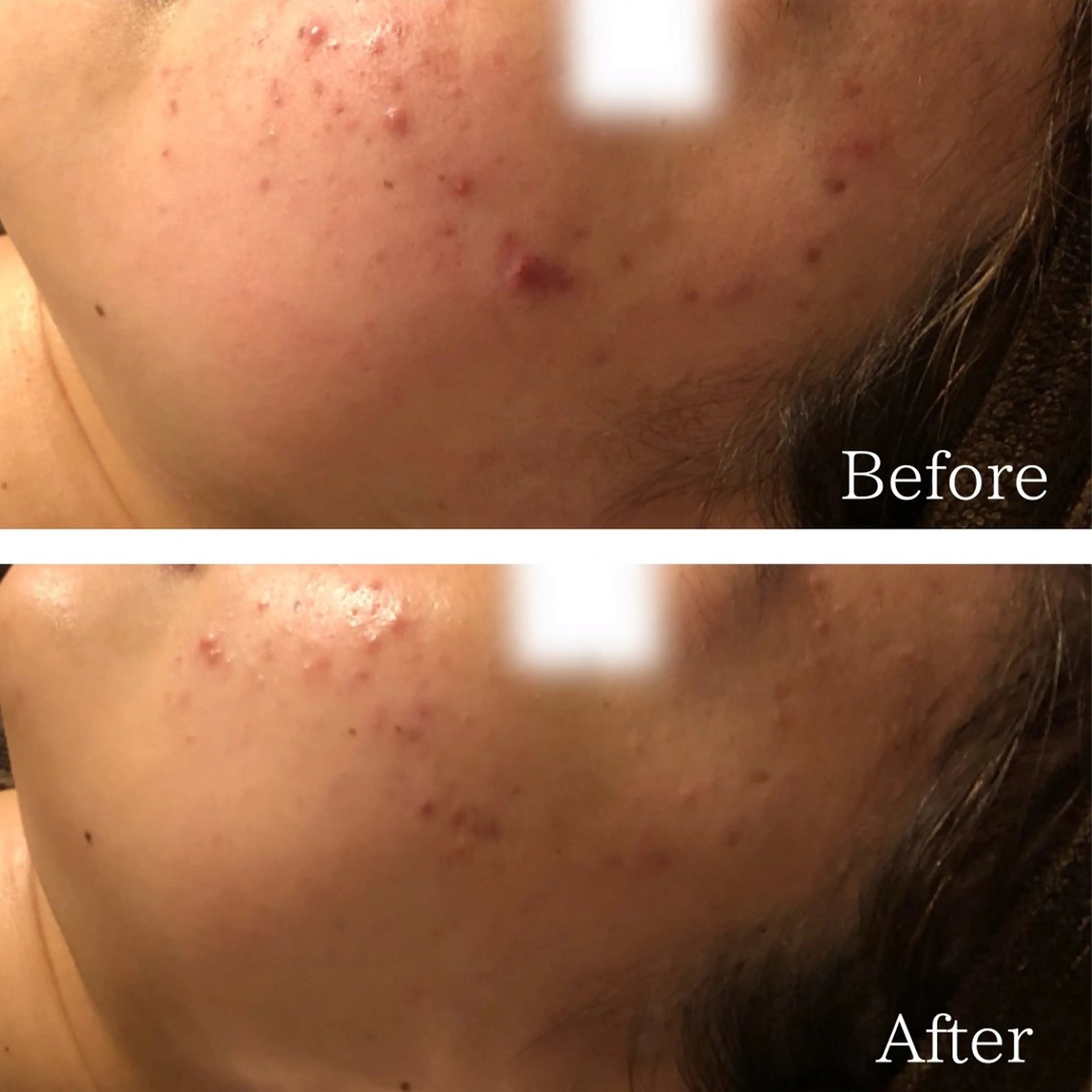 エステ 痩身専門サロン ビューティーグランツのエステ・リラクイメージ