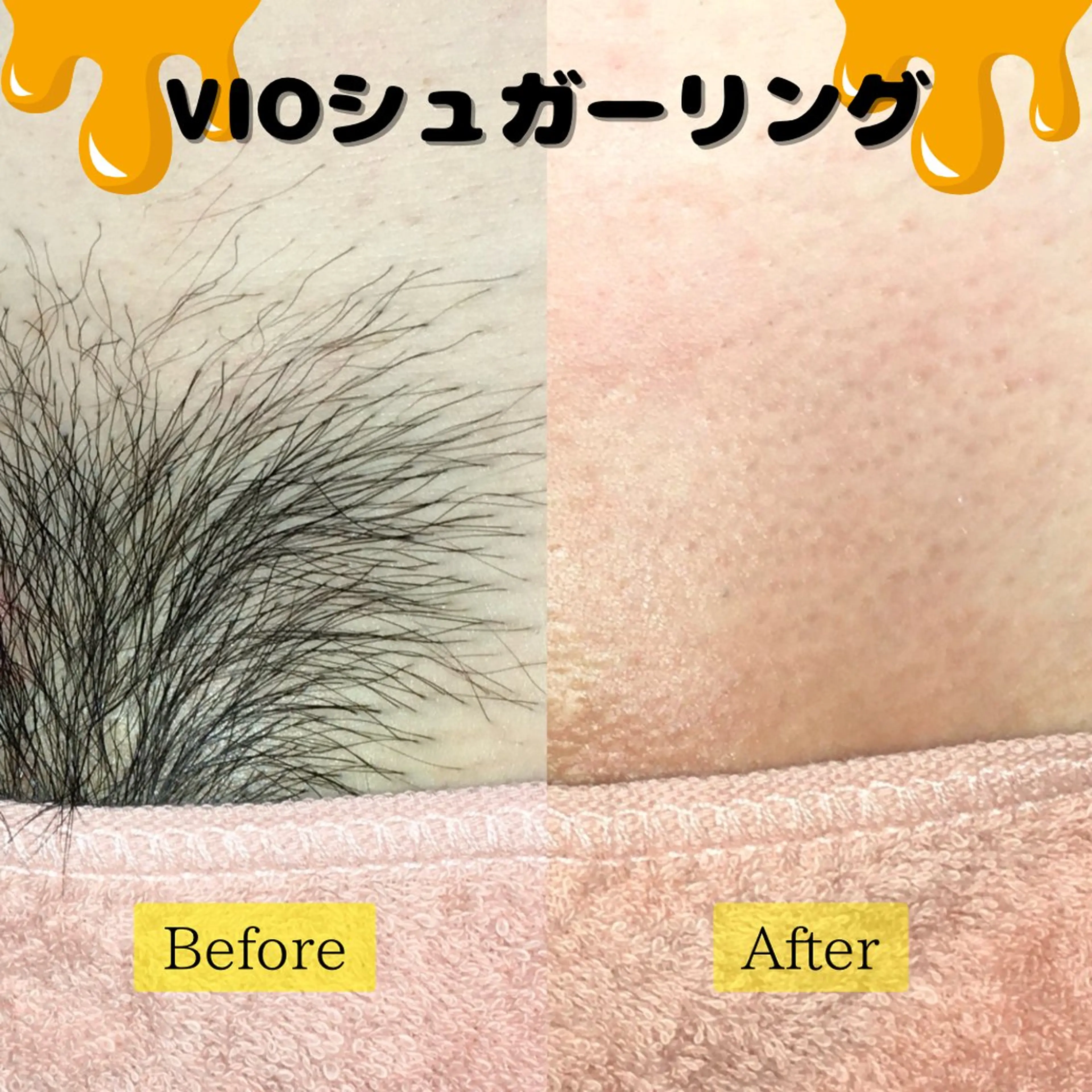 Minuet ミヌエットのエステ・リラクイメージ