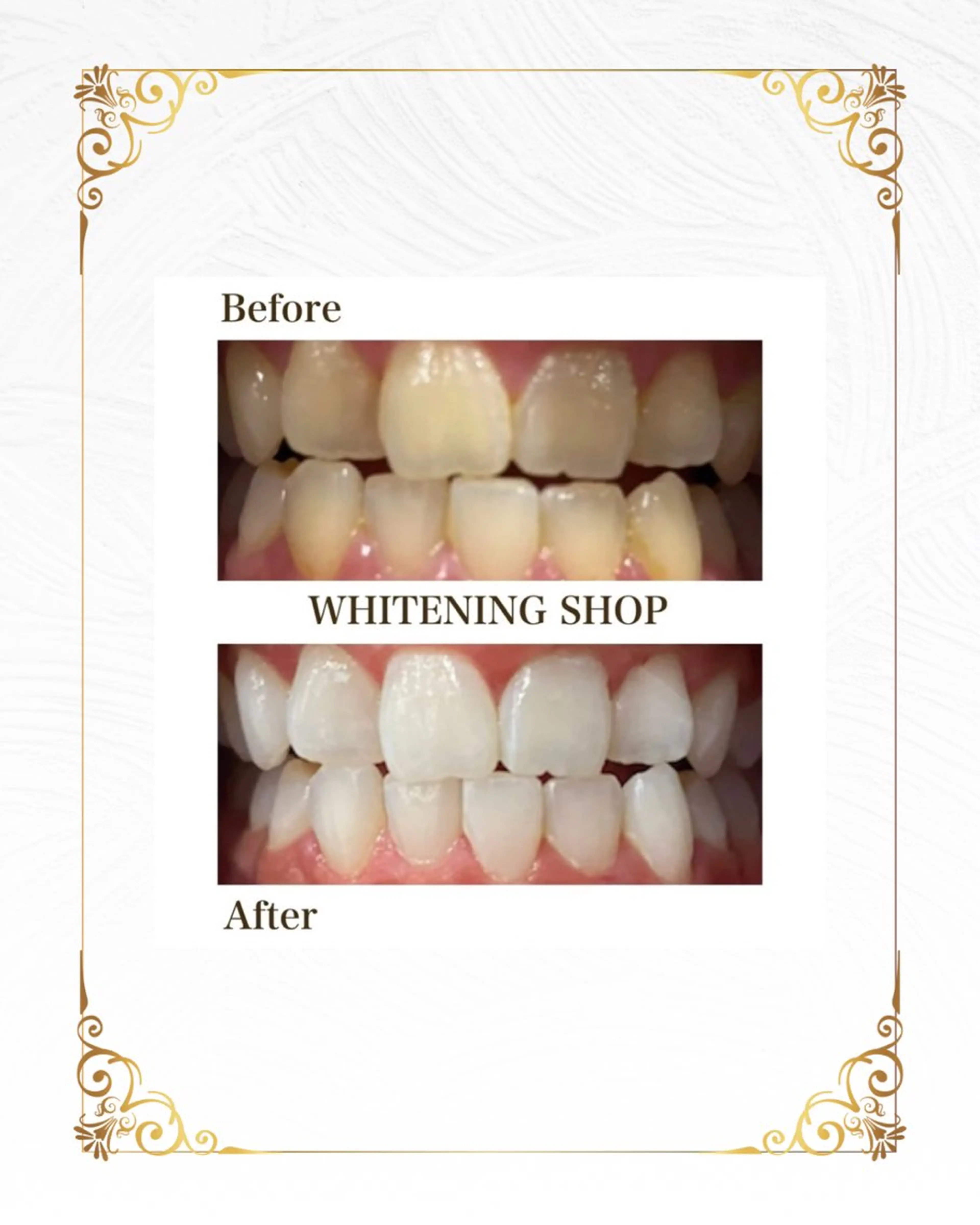 ホワイトニング ショップ葵区静岡駅店のその他イメージ