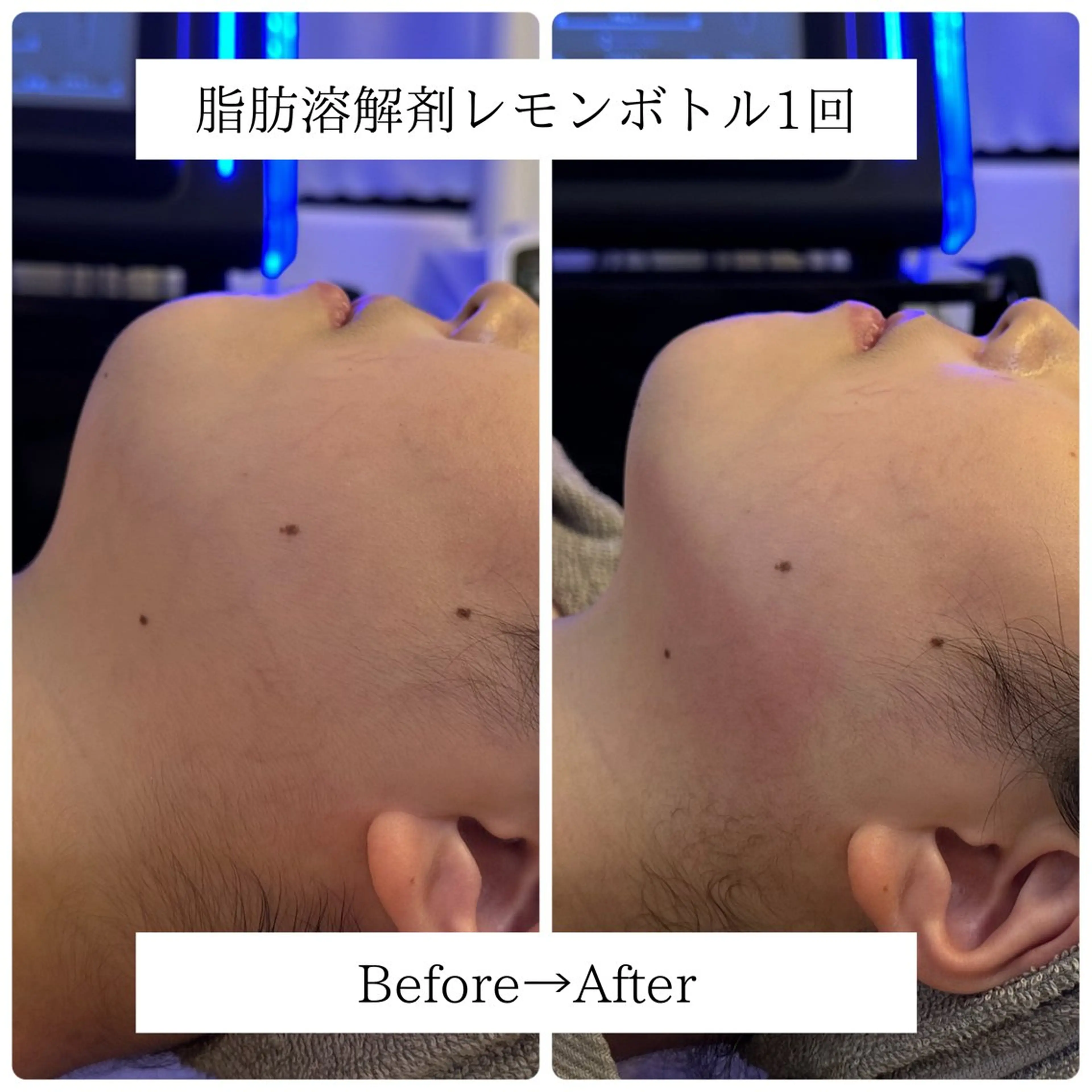 エステ Lino me 島谷夢奈のエステ・リラクイメージ
