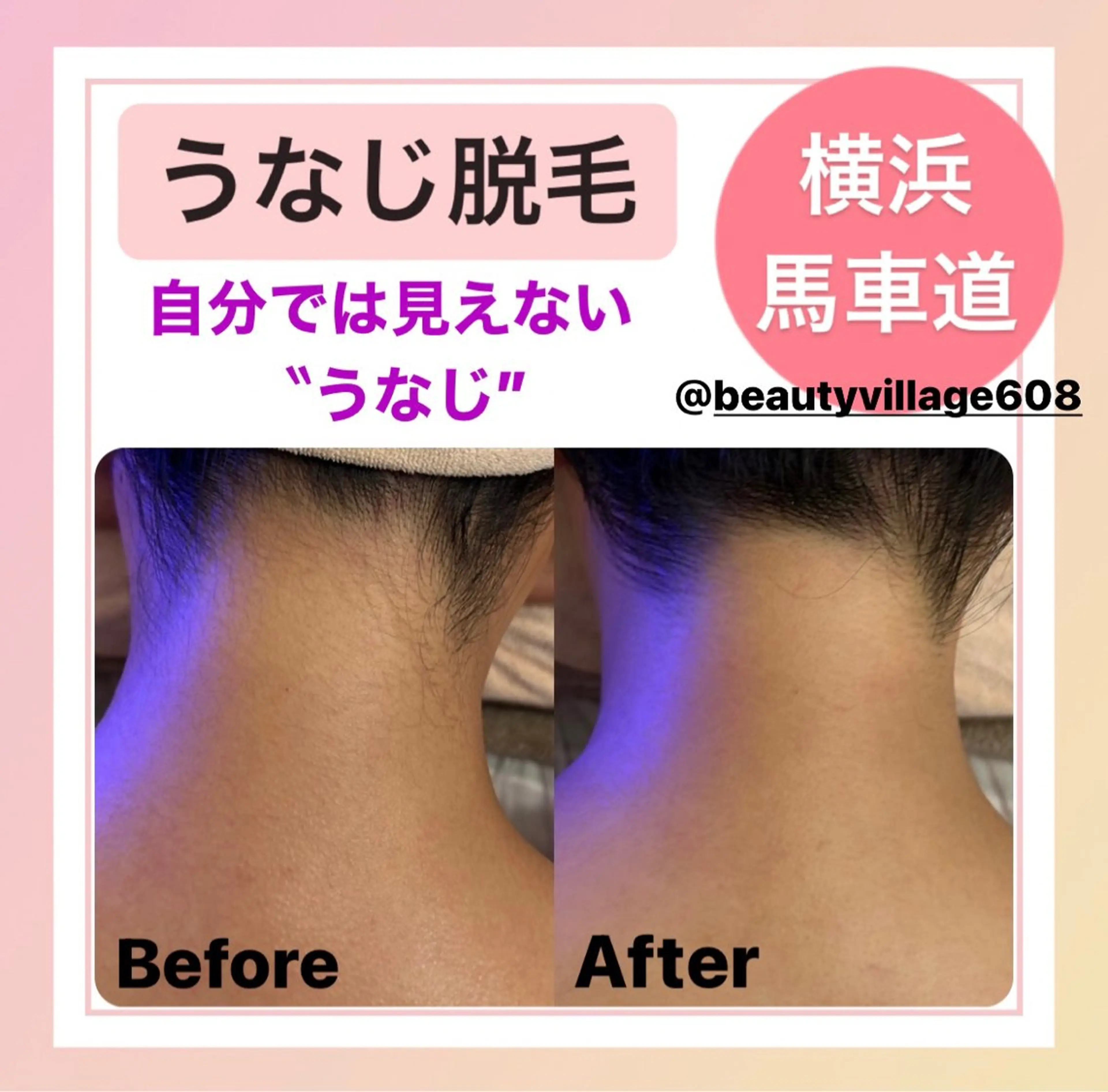 脱毛専門店《横浜•馬車道店》肌質改善所属・【都度払い脱毛】毛穴 専門サロン  馬車道のエステ・リラクイメージ