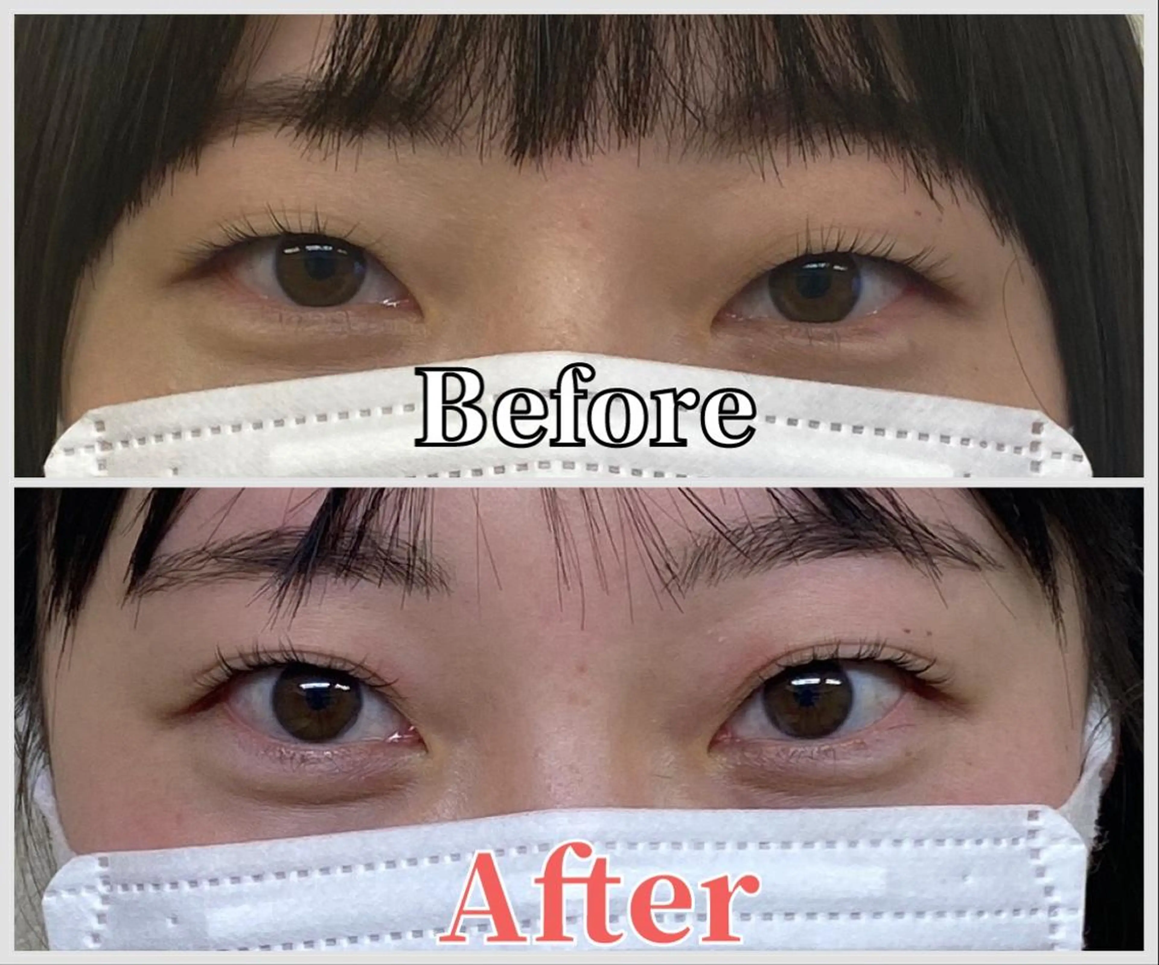 ⭐️初回モニター限定⭐️二重整体コース✨の写真