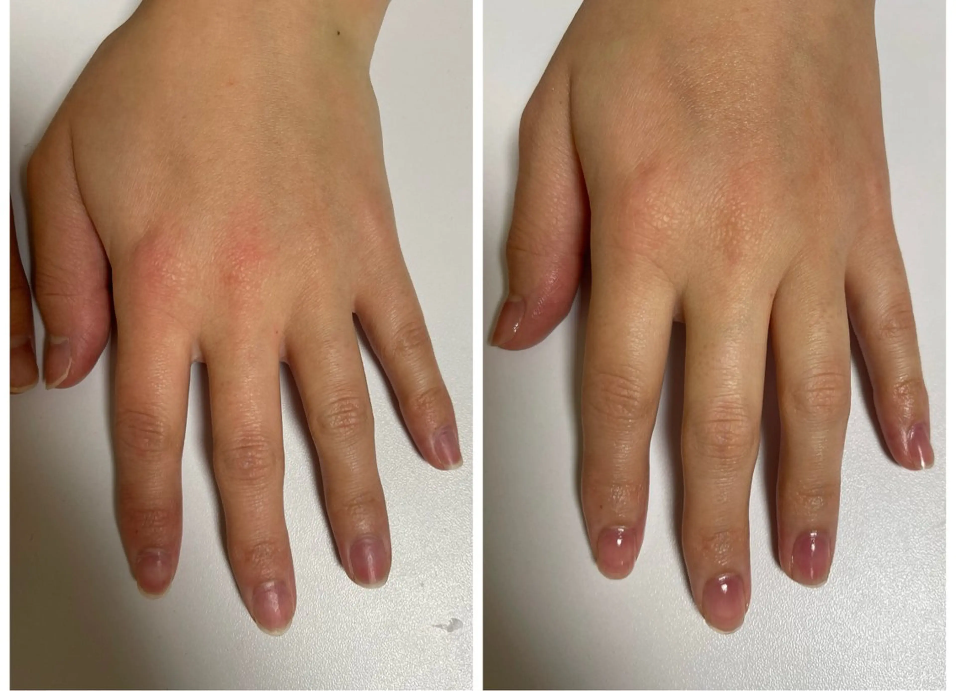 ネイル 🔰 新米ネイリストのネイルデザイン