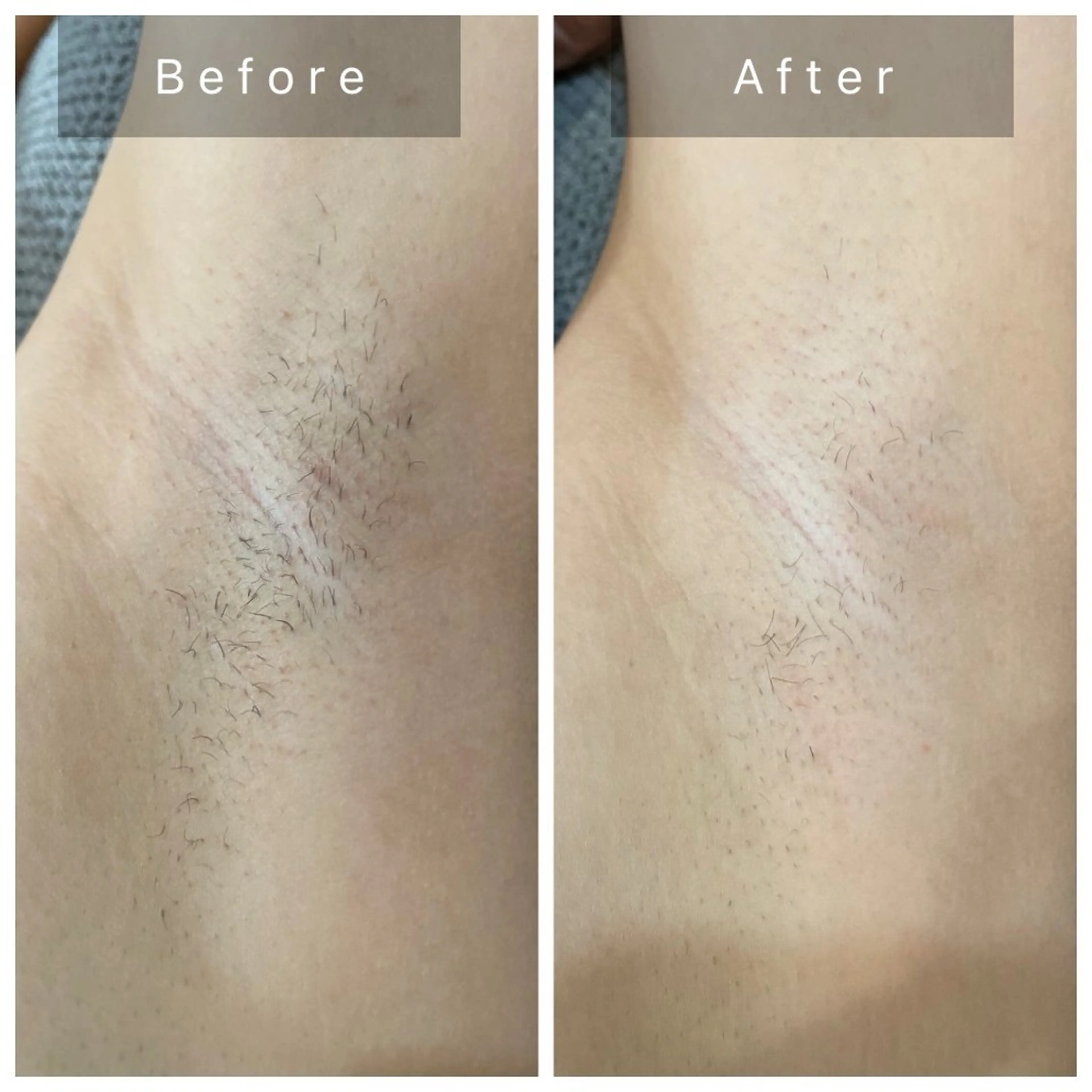 エステ salon de perfectionのエステ・リラクイメージ