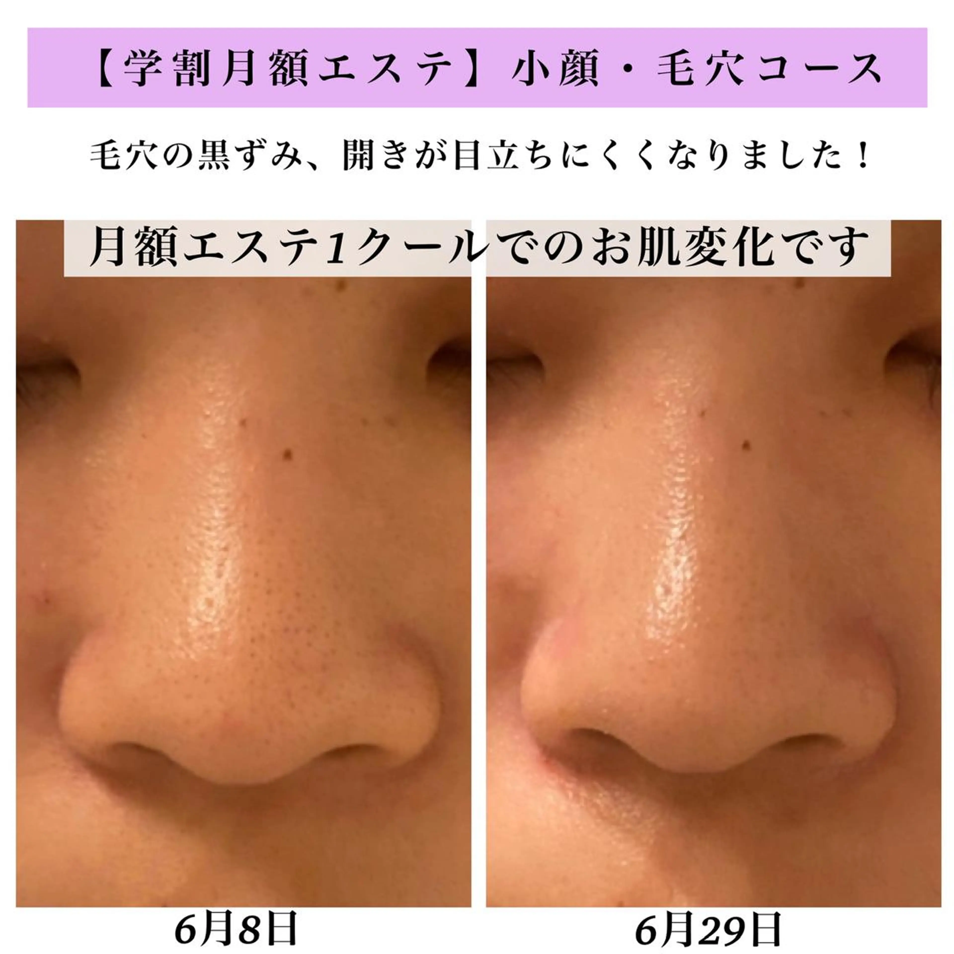 Bellesthe （ベルエステ）のエステ・リラクイメージ