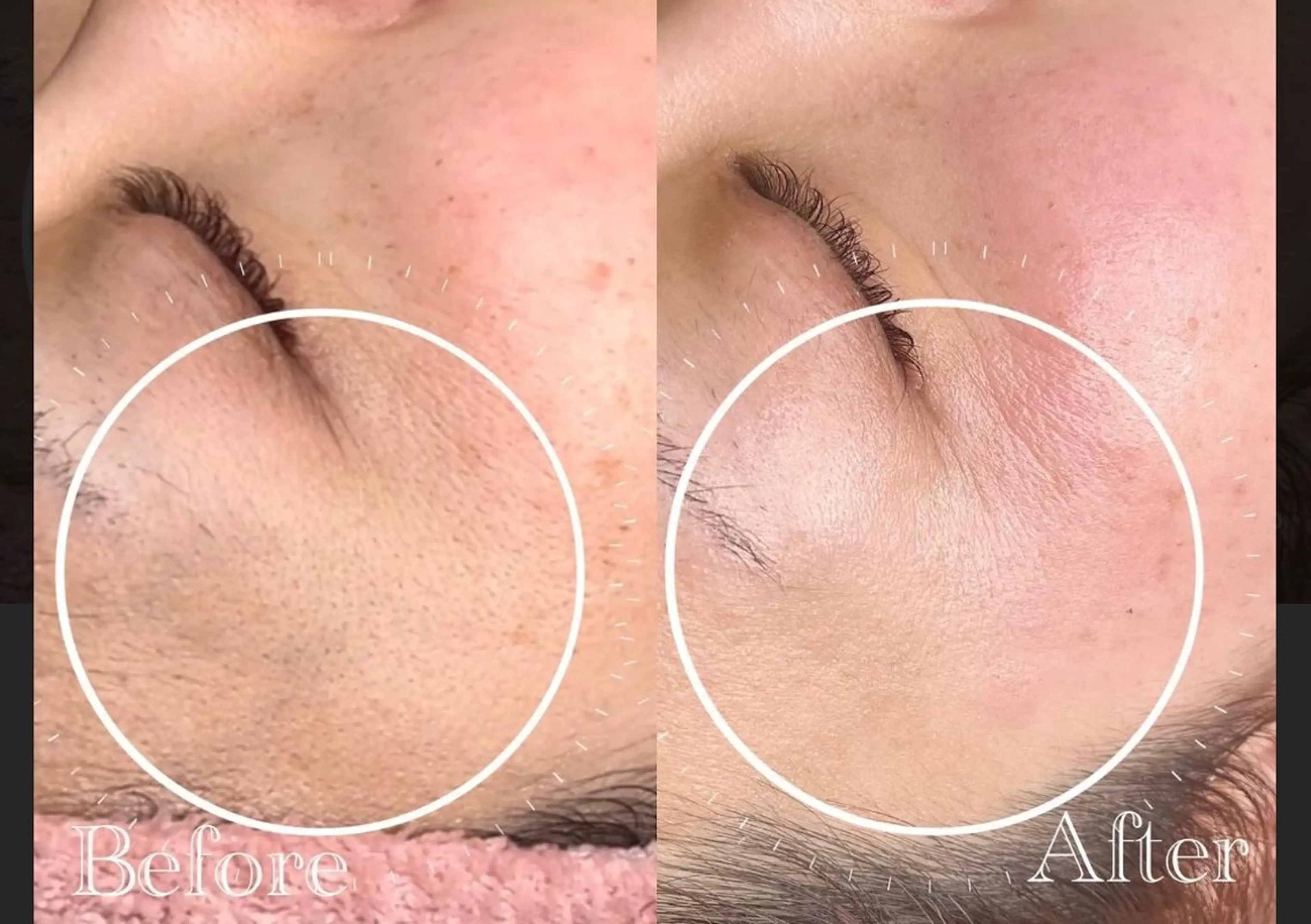 脱毛 NaKid マツエク&マツパのマツエク・マツパデザイン