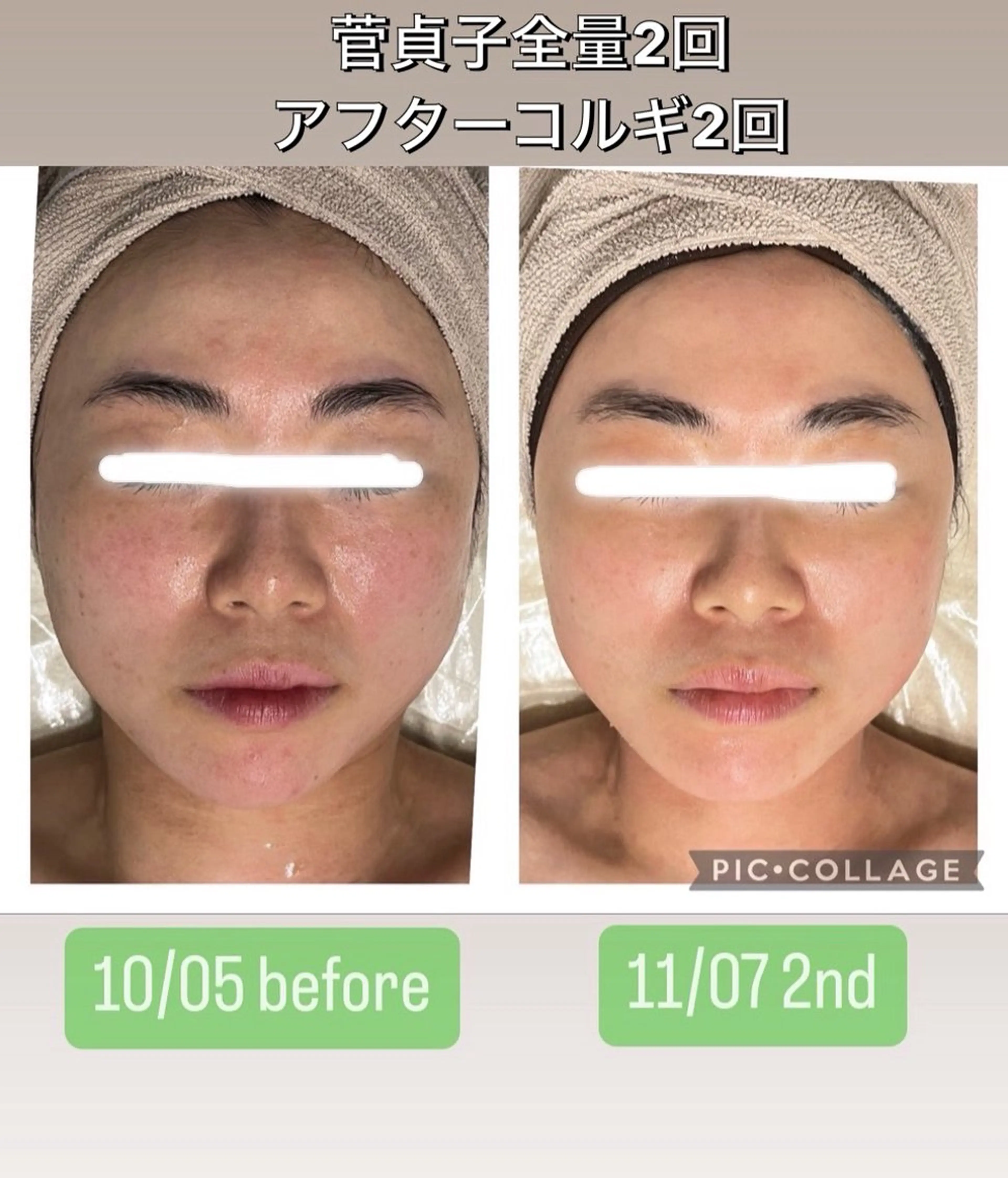 SALON DE GiGiのエステ・リラクイメージ