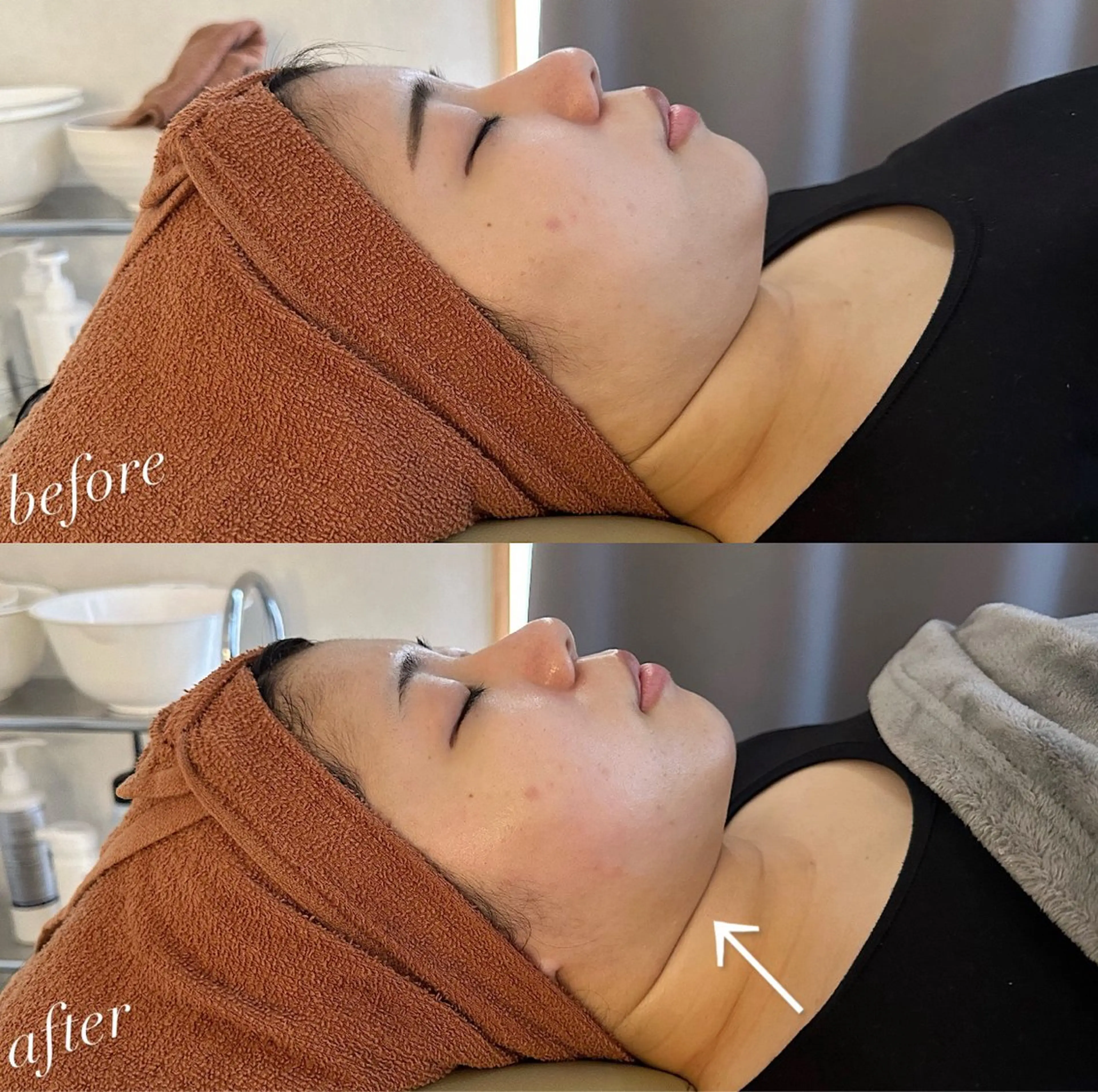 うなじ脱毛/美肌脱毛 LABELのエステ・リラクイメージ