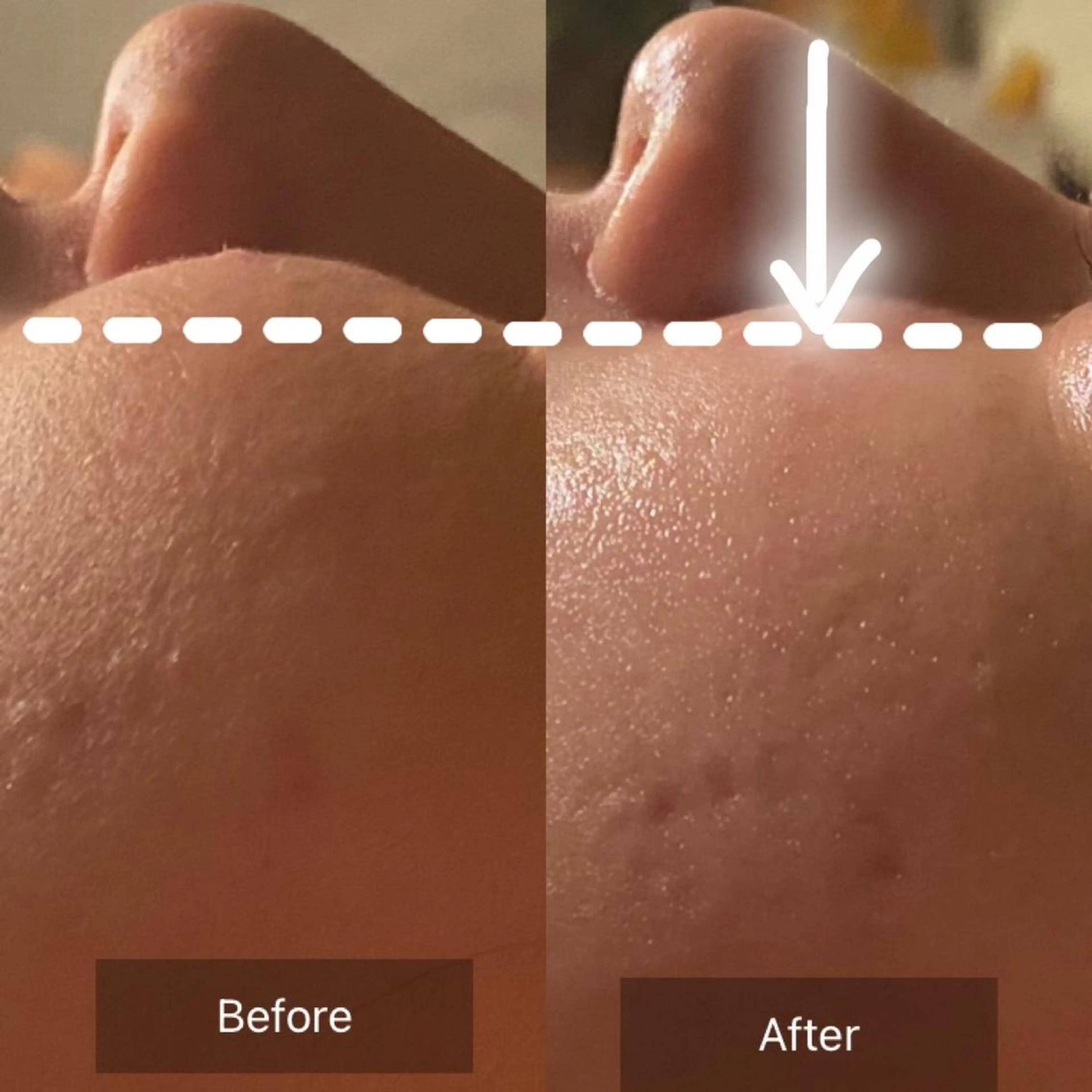 Mandarin Orange所属・毛穴から始める肌メン テマンダリンオレンジのエステ・リラクイメージ