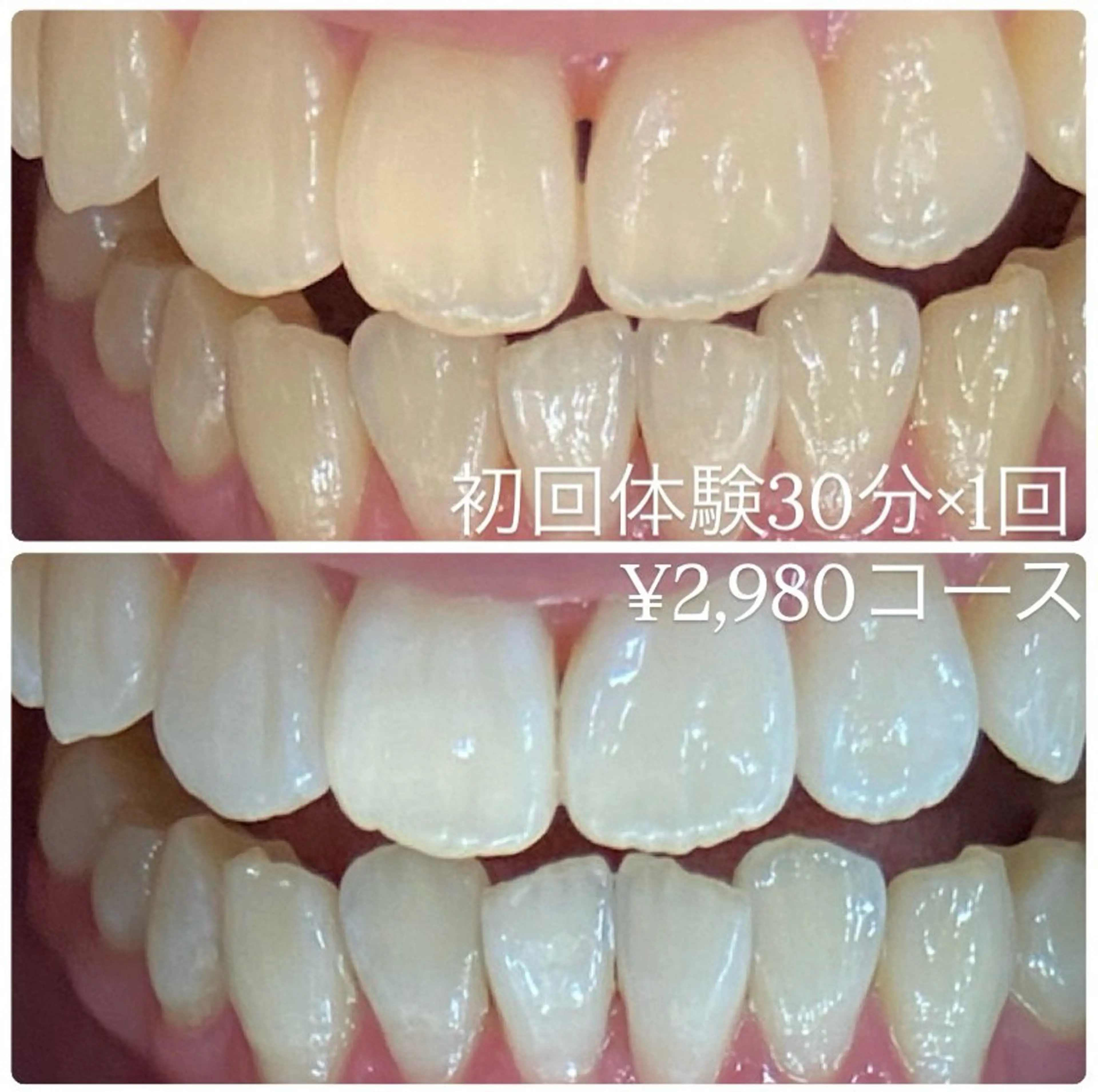 その他 PLATINUM Beauty 横浜店所属・ホワイトニングルーム 横浜店のその他イメージ