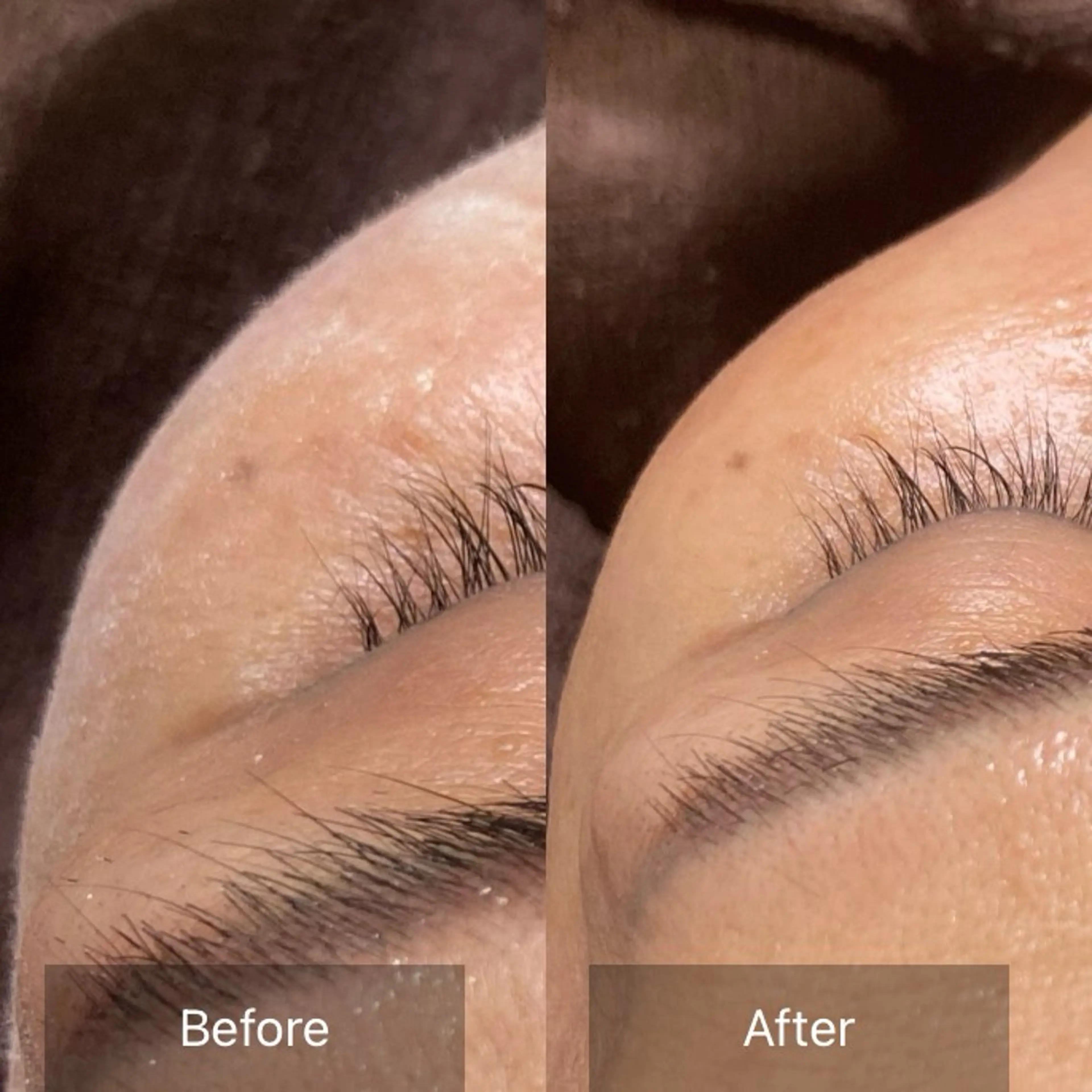 エステ 産毛専門店 Bittoのエステ・リラクイメージ