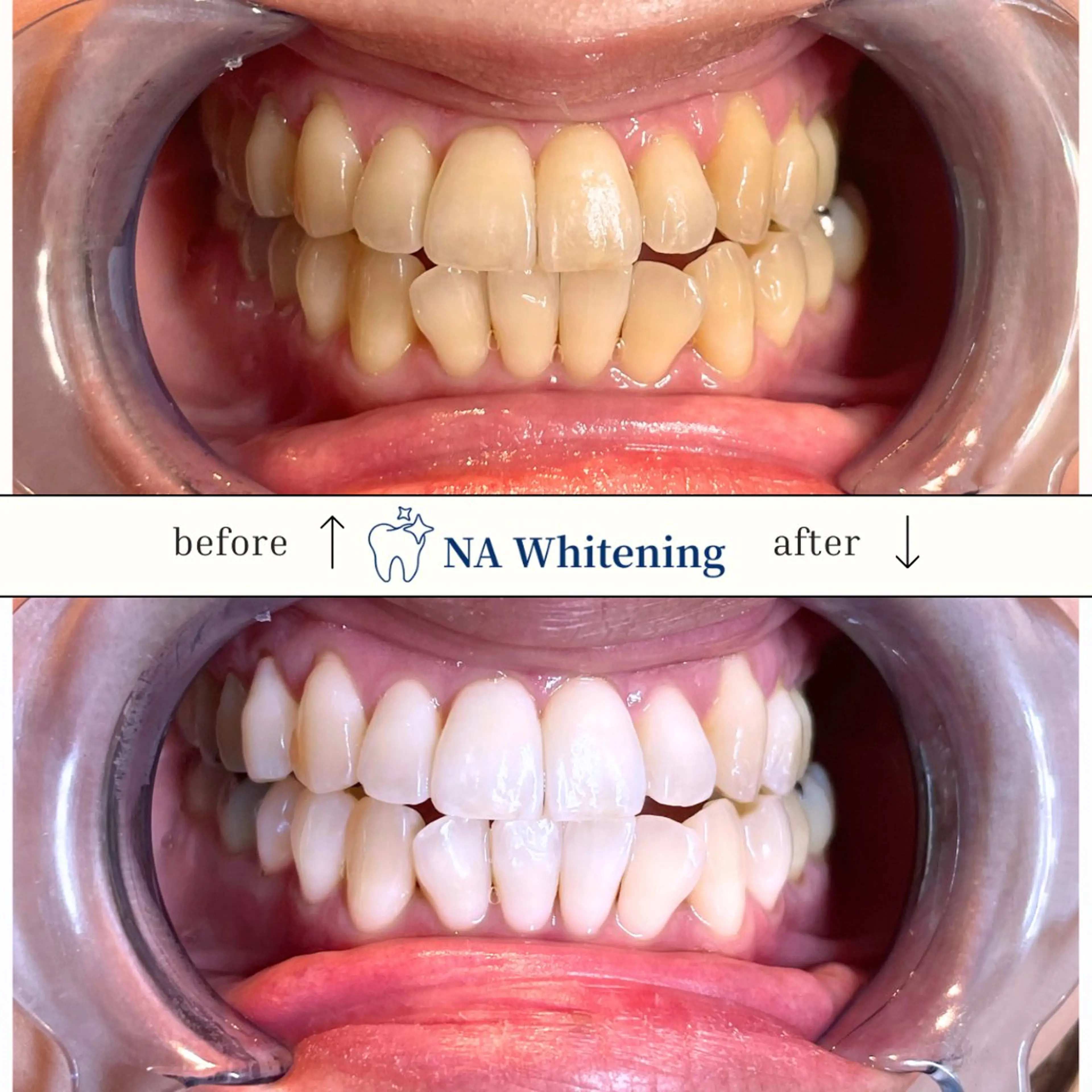 NAホワイトニング 溝の口店のエステ・リラクイメージ