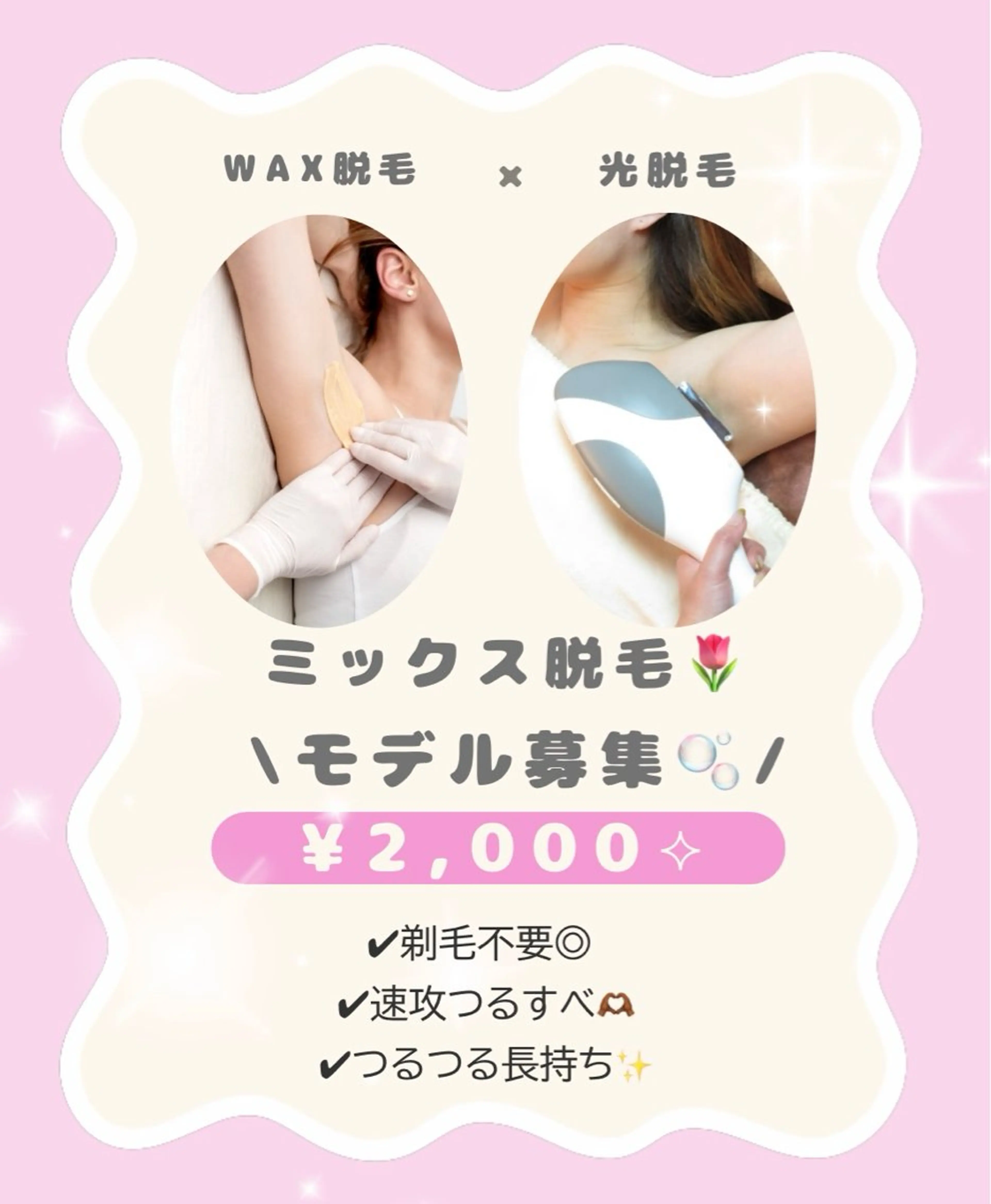 VIOミックス脱毛 (ワックス脱毛➕光脱毛) 🪽🫧モデル(女性限定)の写真