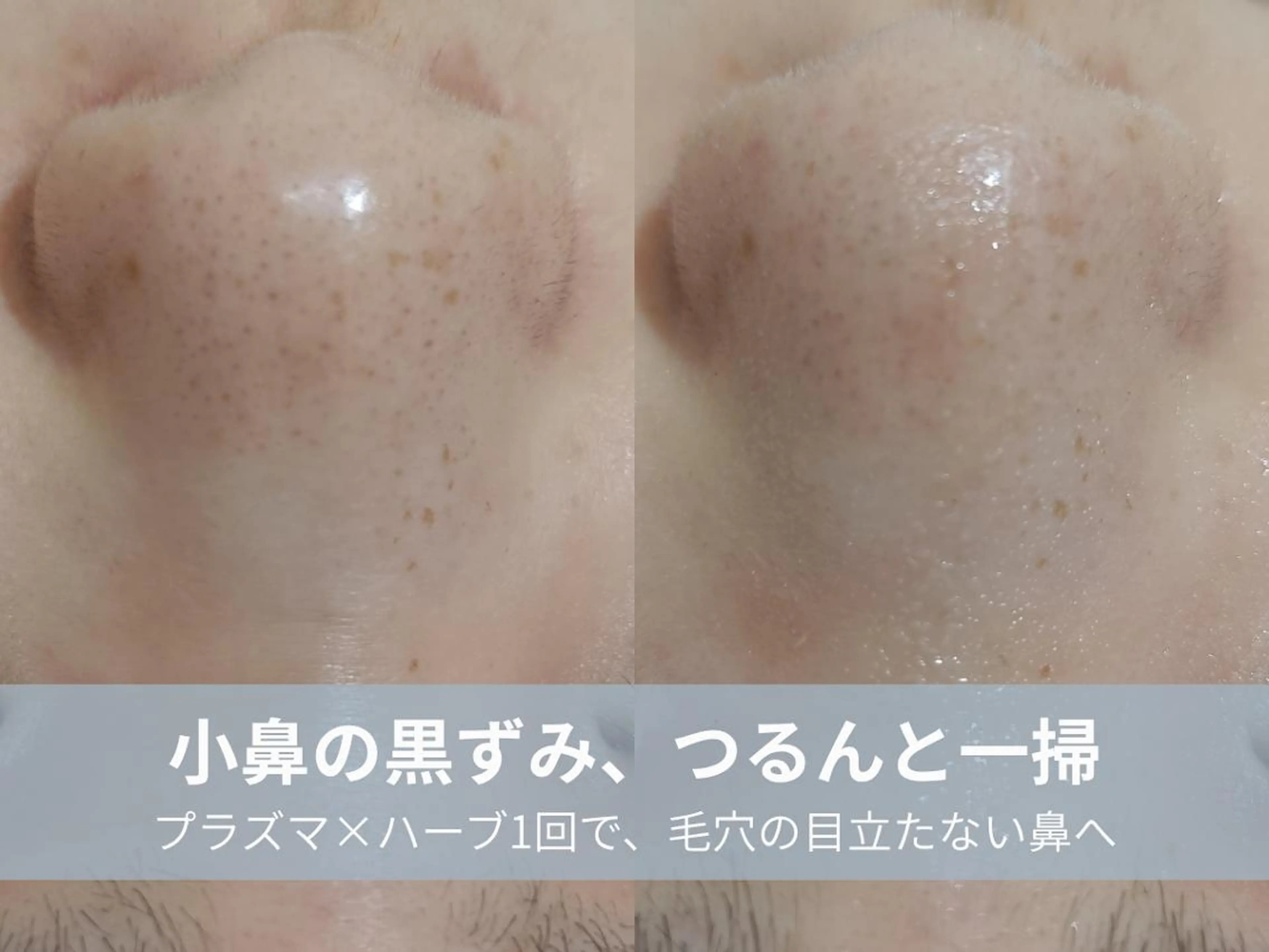 エステ La chic.のエステ・リラクイメージ