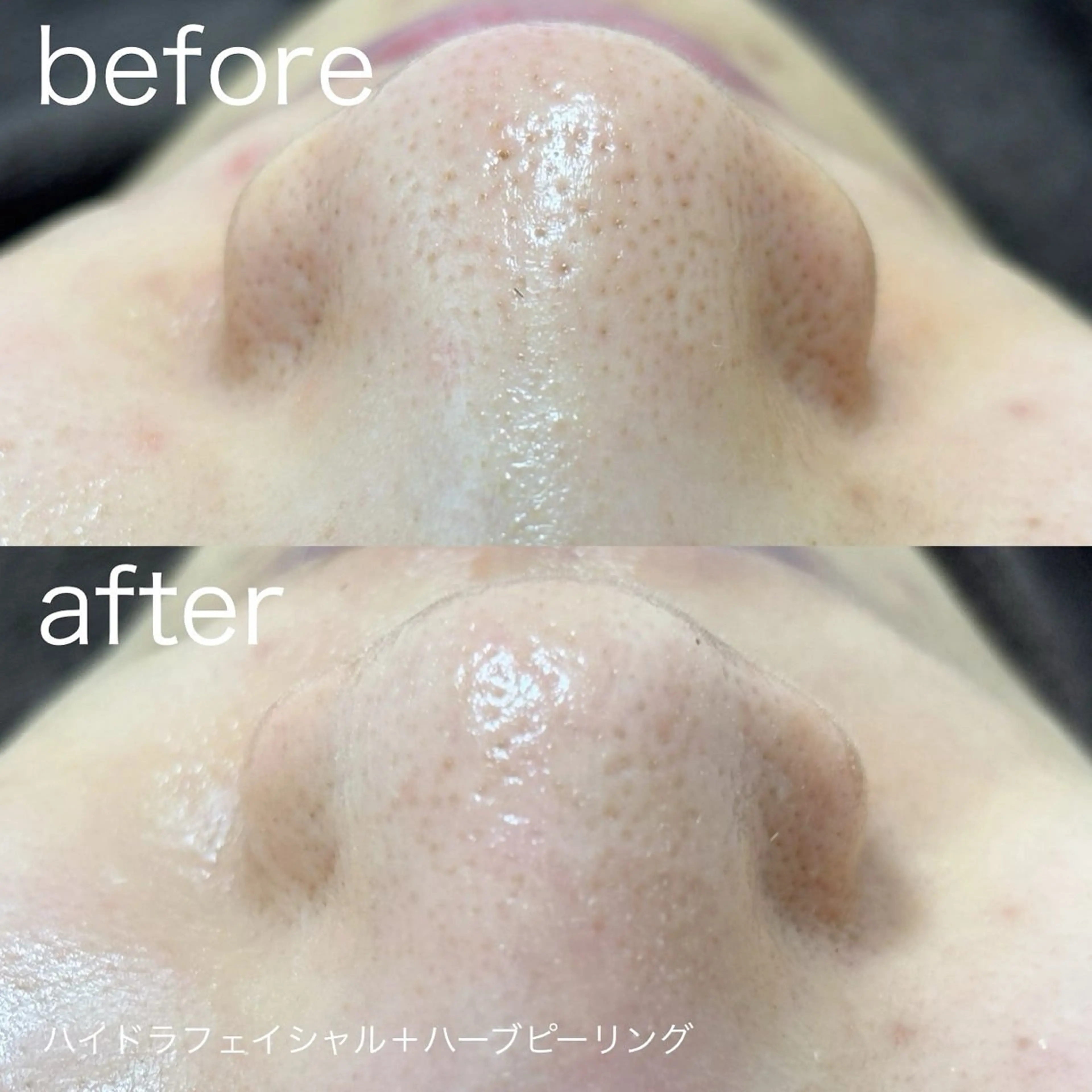 lulularico Yuのエステ・リラクイメージ