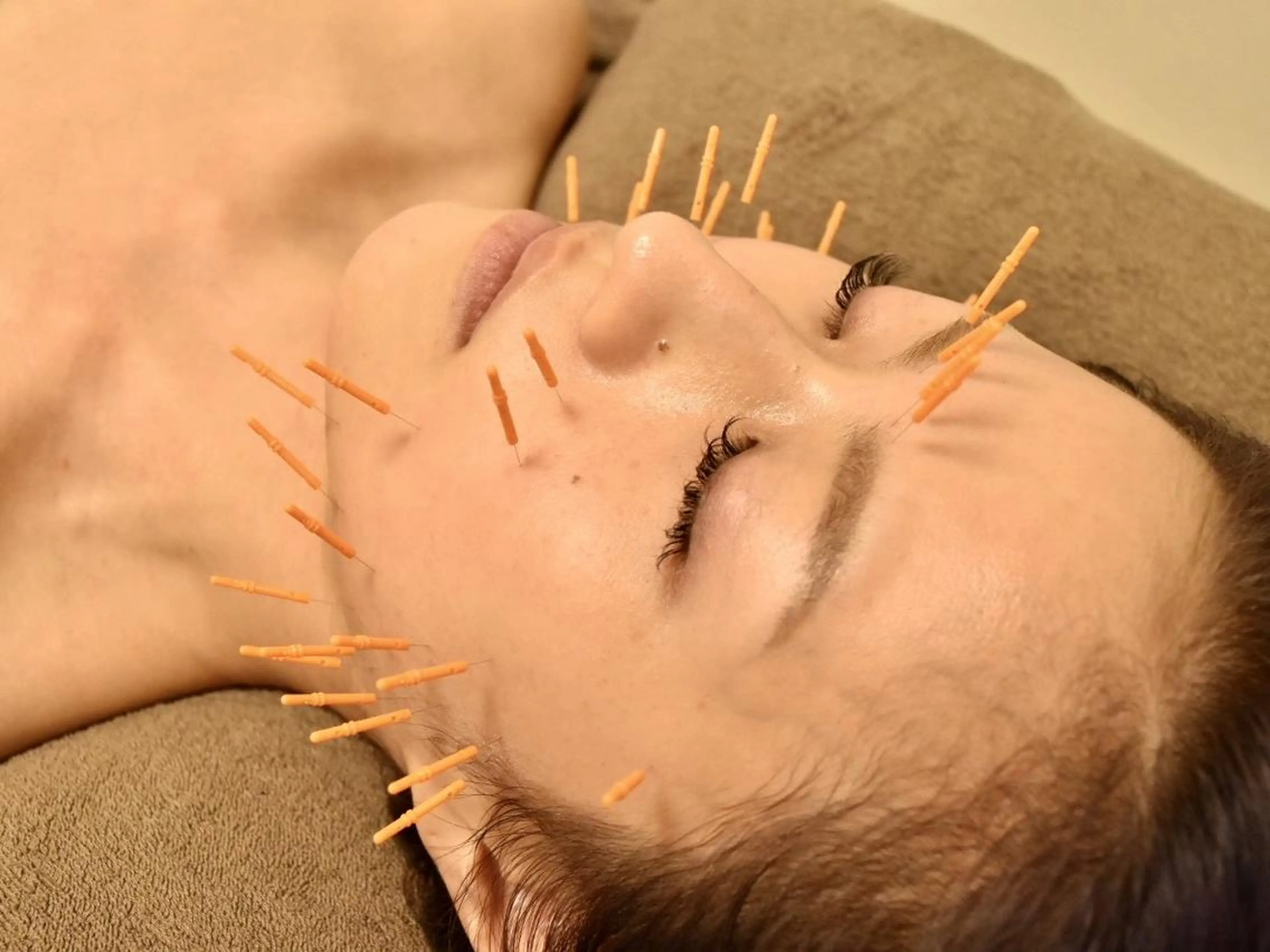 【新規】【選べる】美顔鍼フェイシャル+ヒト幹orプラセンタ 50分¥15400→¥6990の写真