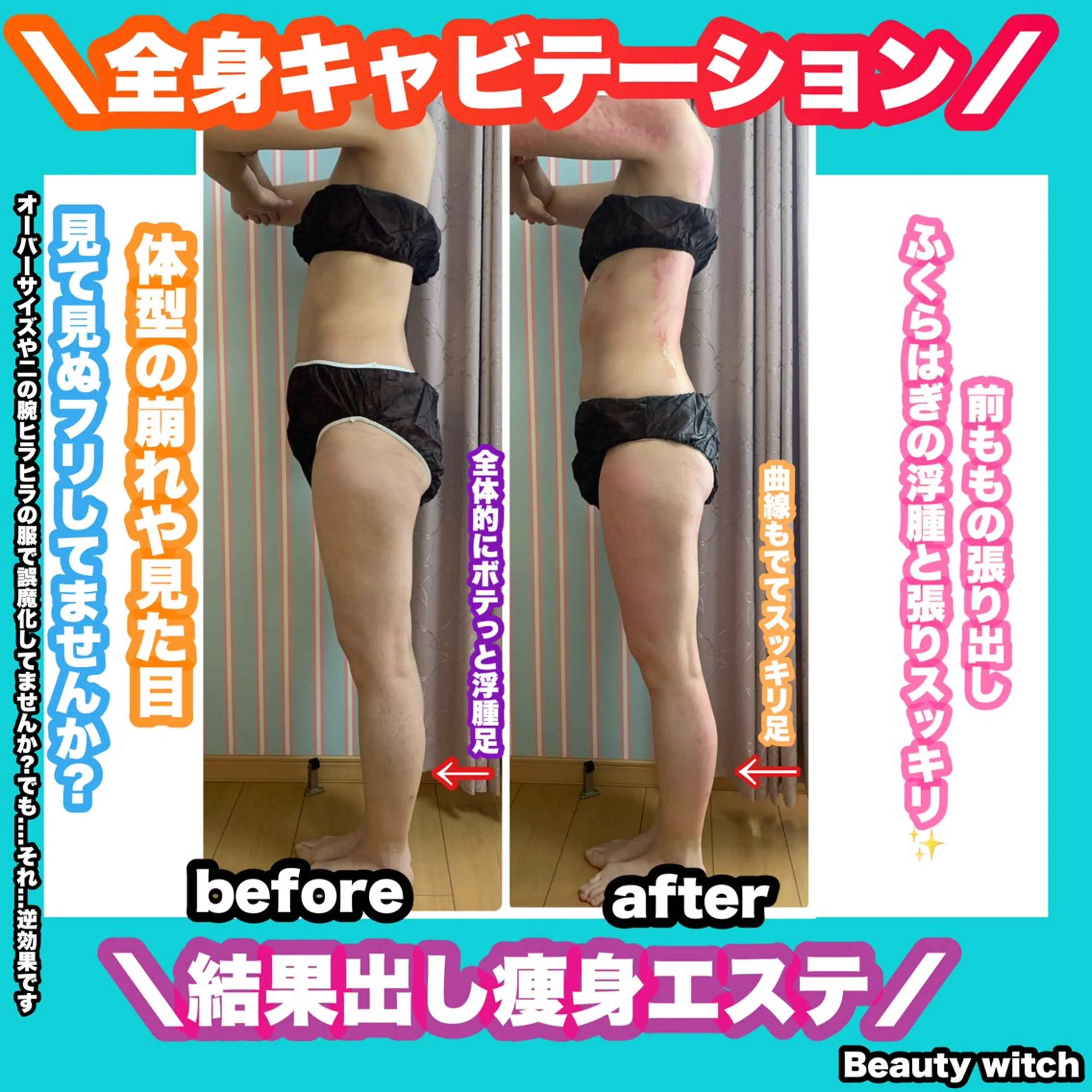 エステ リラク 痩身/脱毛/ネイル HARUKAのエステ・リラクイメージ