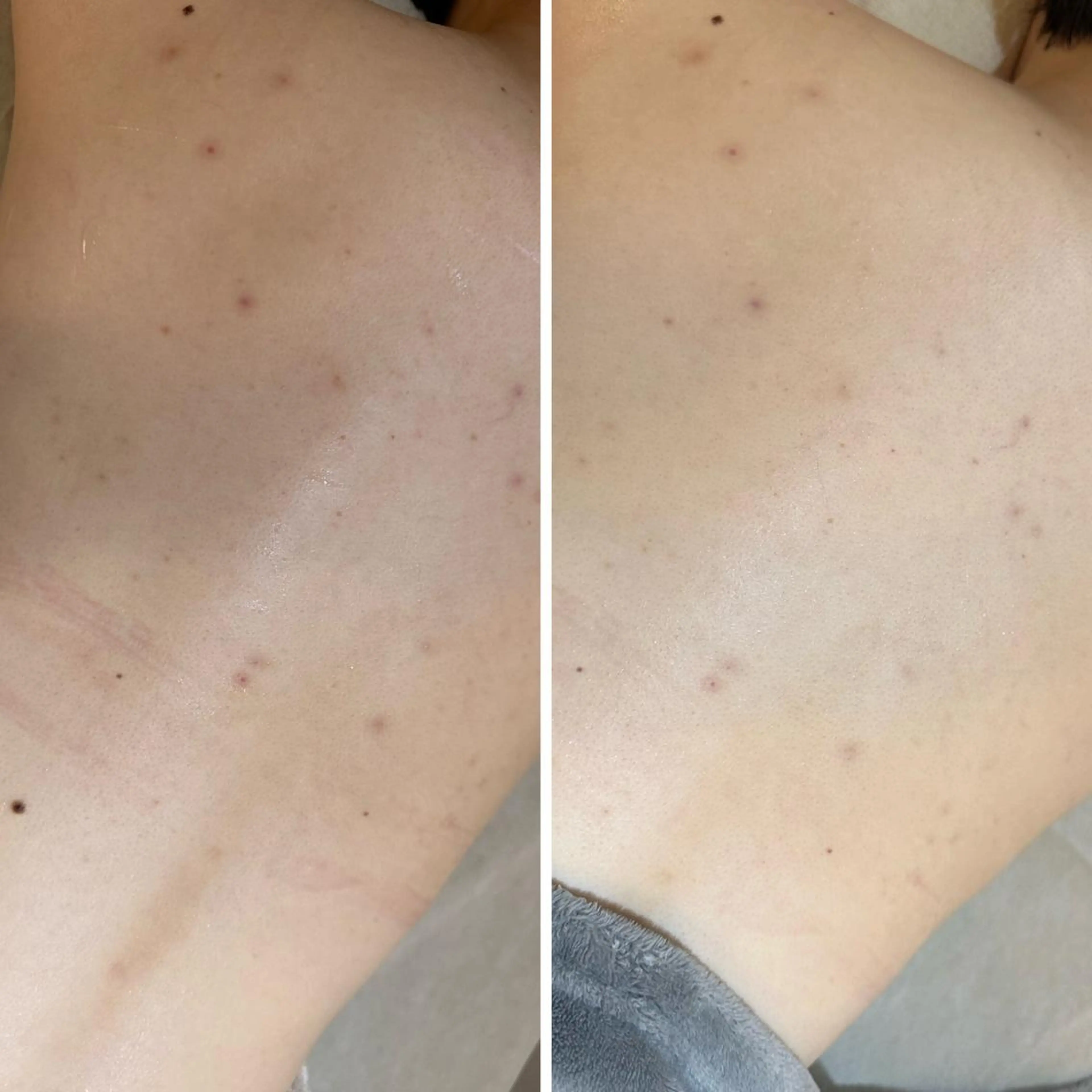 うなじ脱毛/美肌脱毛 LABELのエステ・リラクイメージ