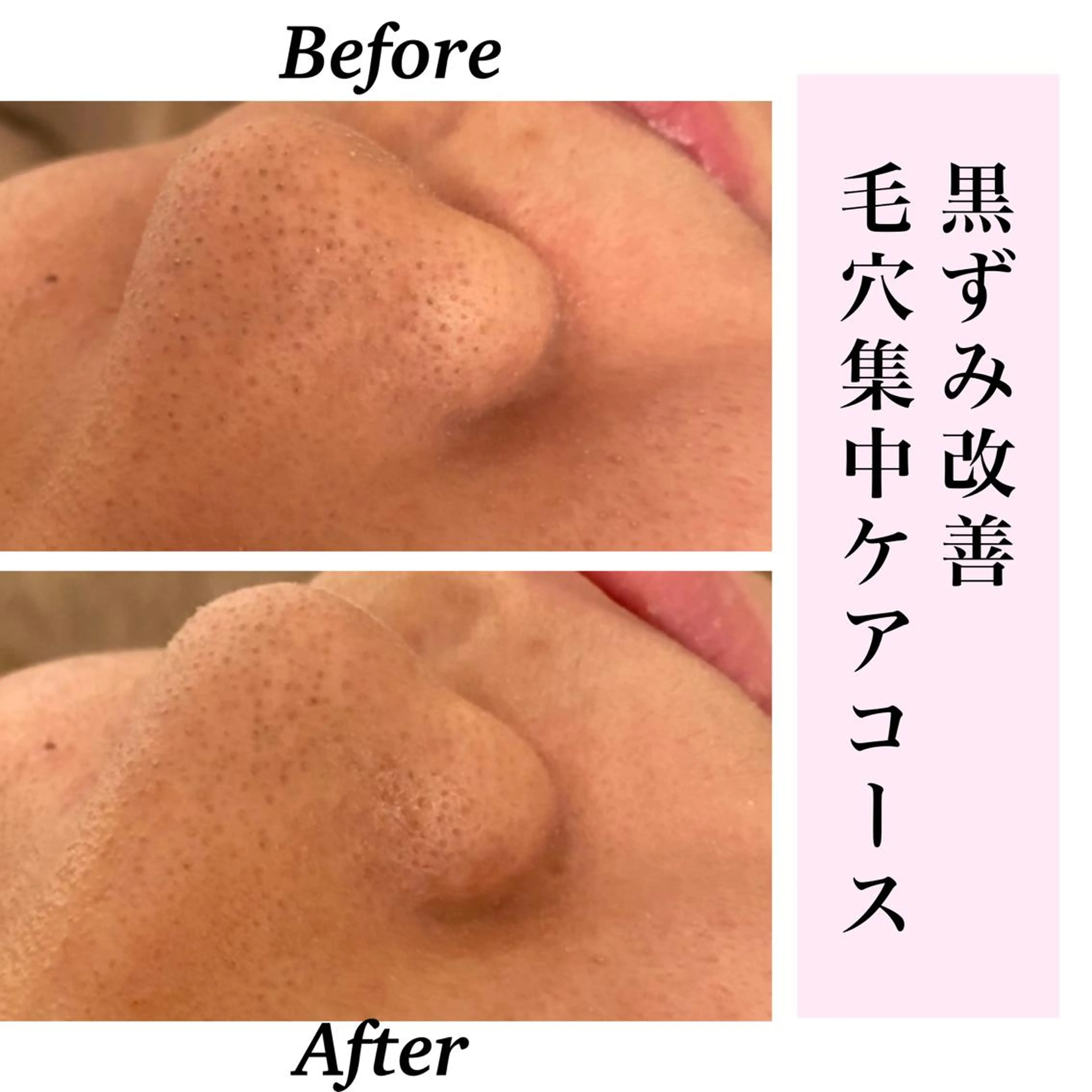 エステ リラク Bellesthe （ベルエステ）のエステ・リラクイメージ