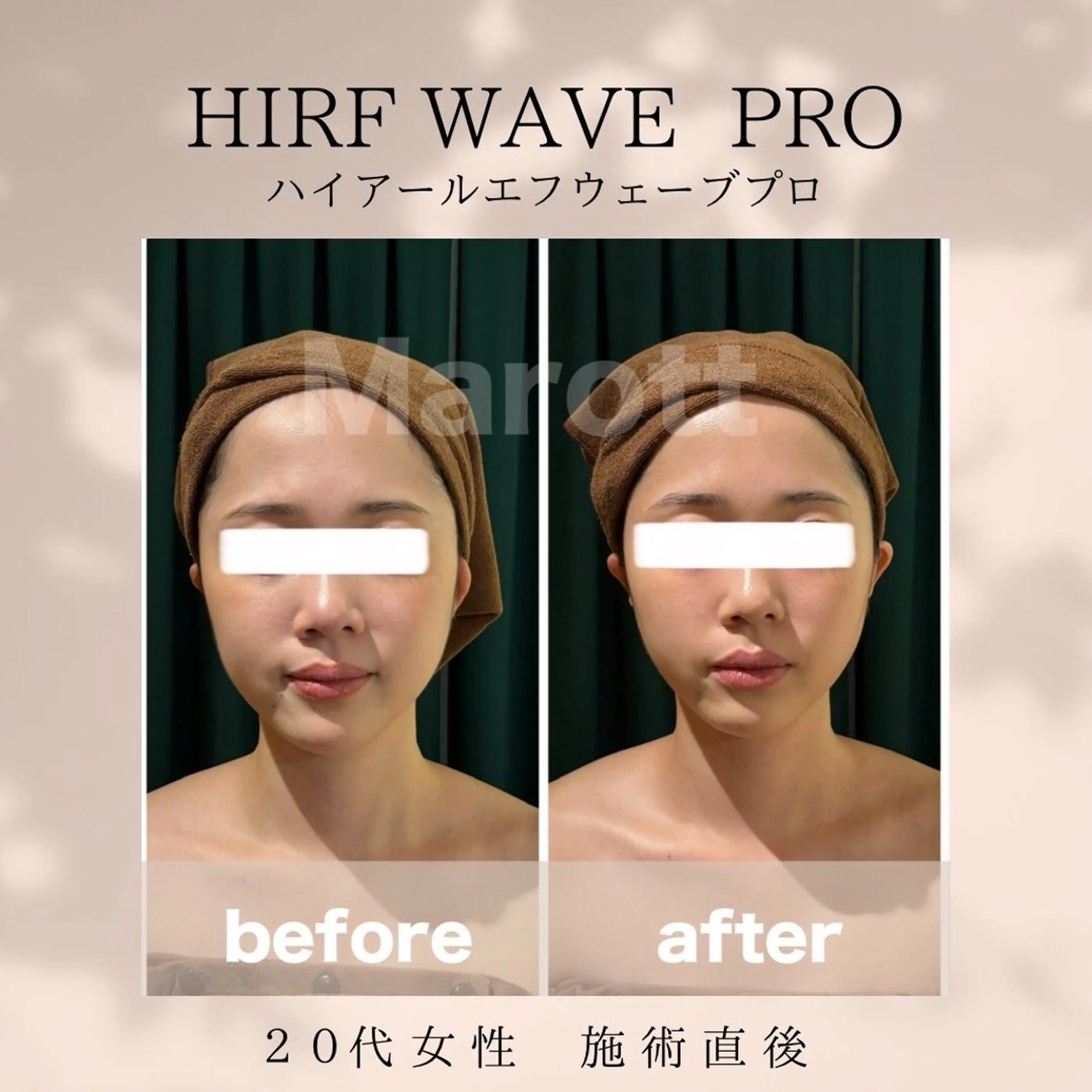 小顔サロン Marottのエステ・リラクイメージ