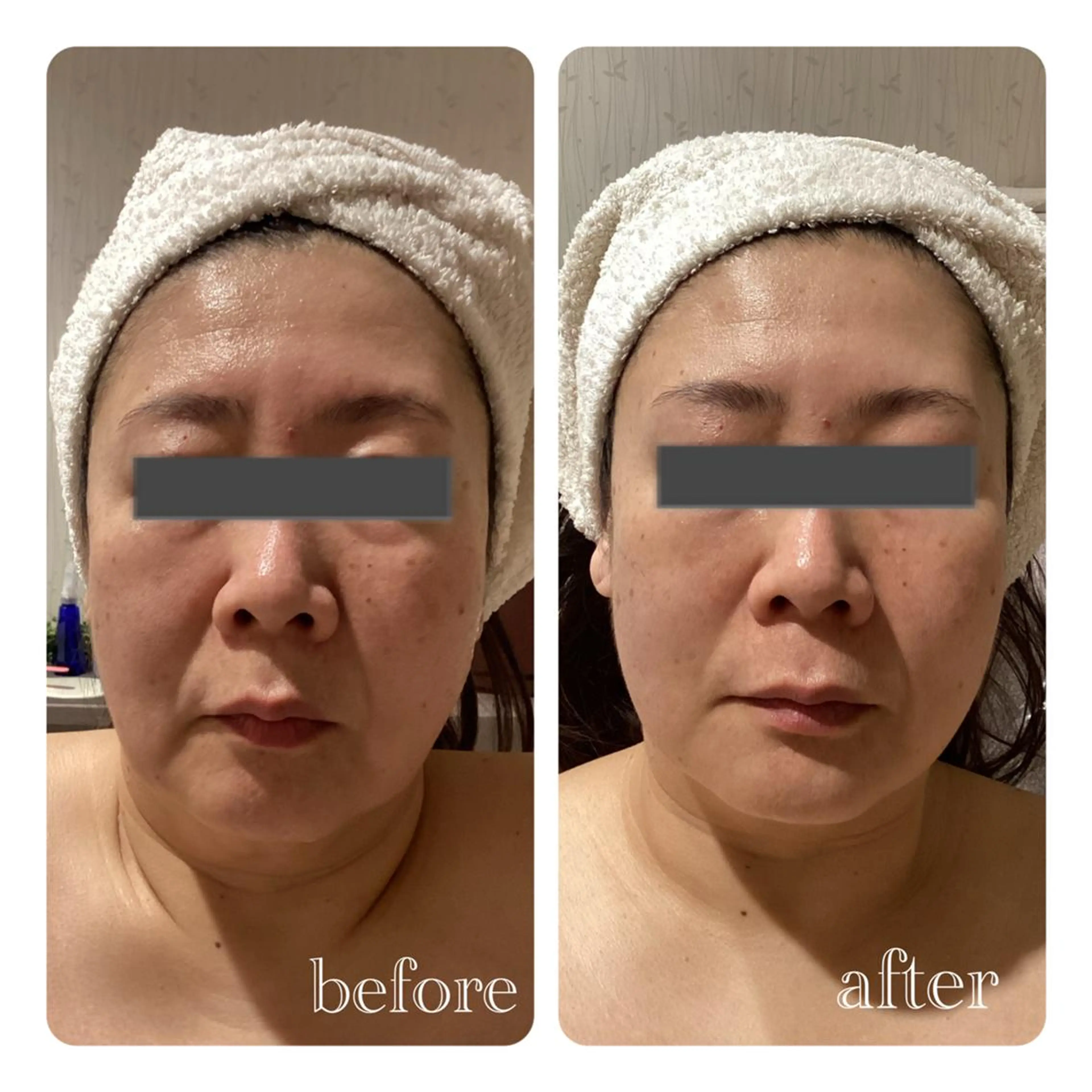 エステ 痩身脱毛専門店 Partirのエステ・リラクイメージ