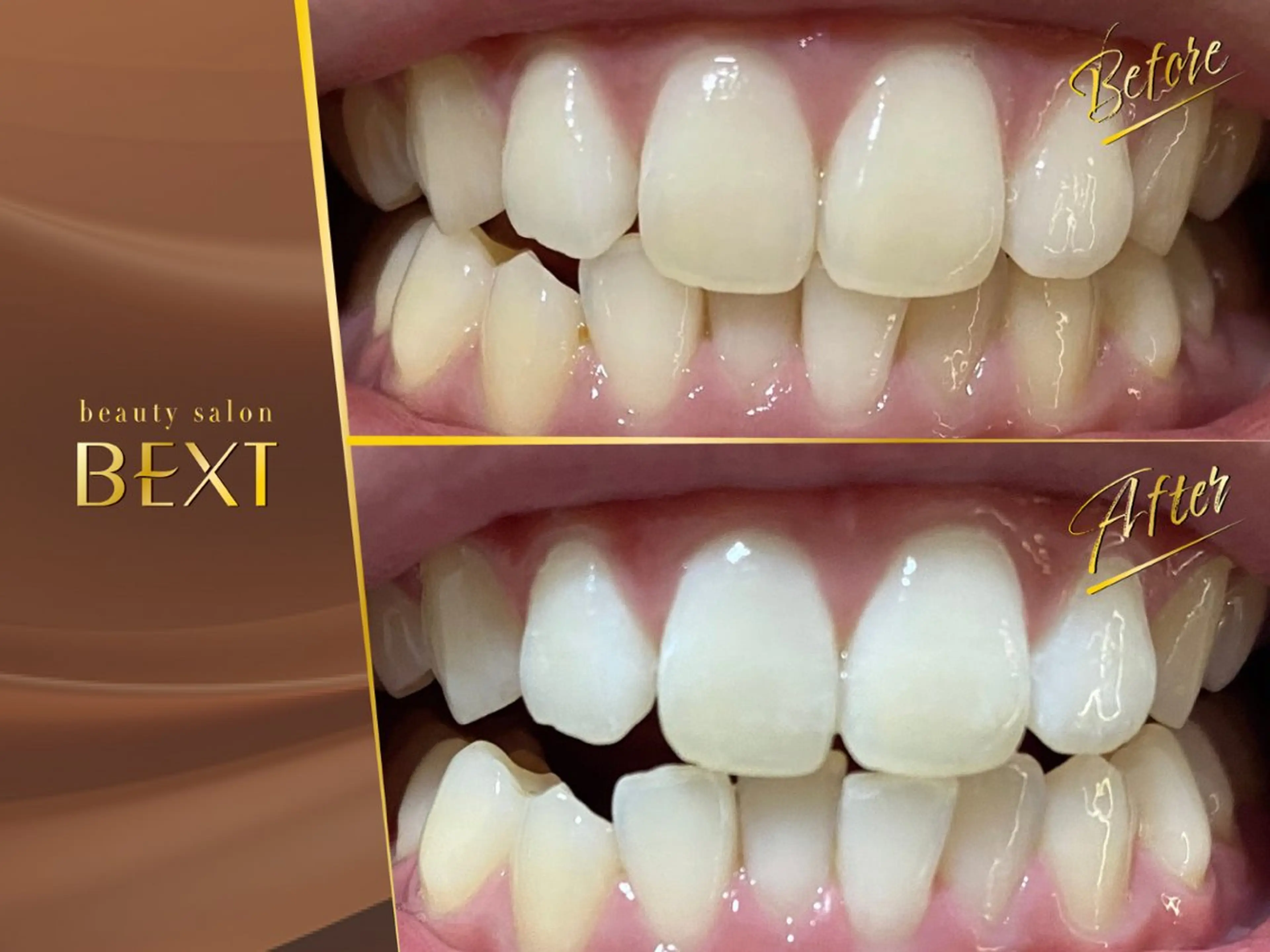 メンズ エステ リラク ビューティーサロン ベクスト名古屋のマツエク・マツパデザイン