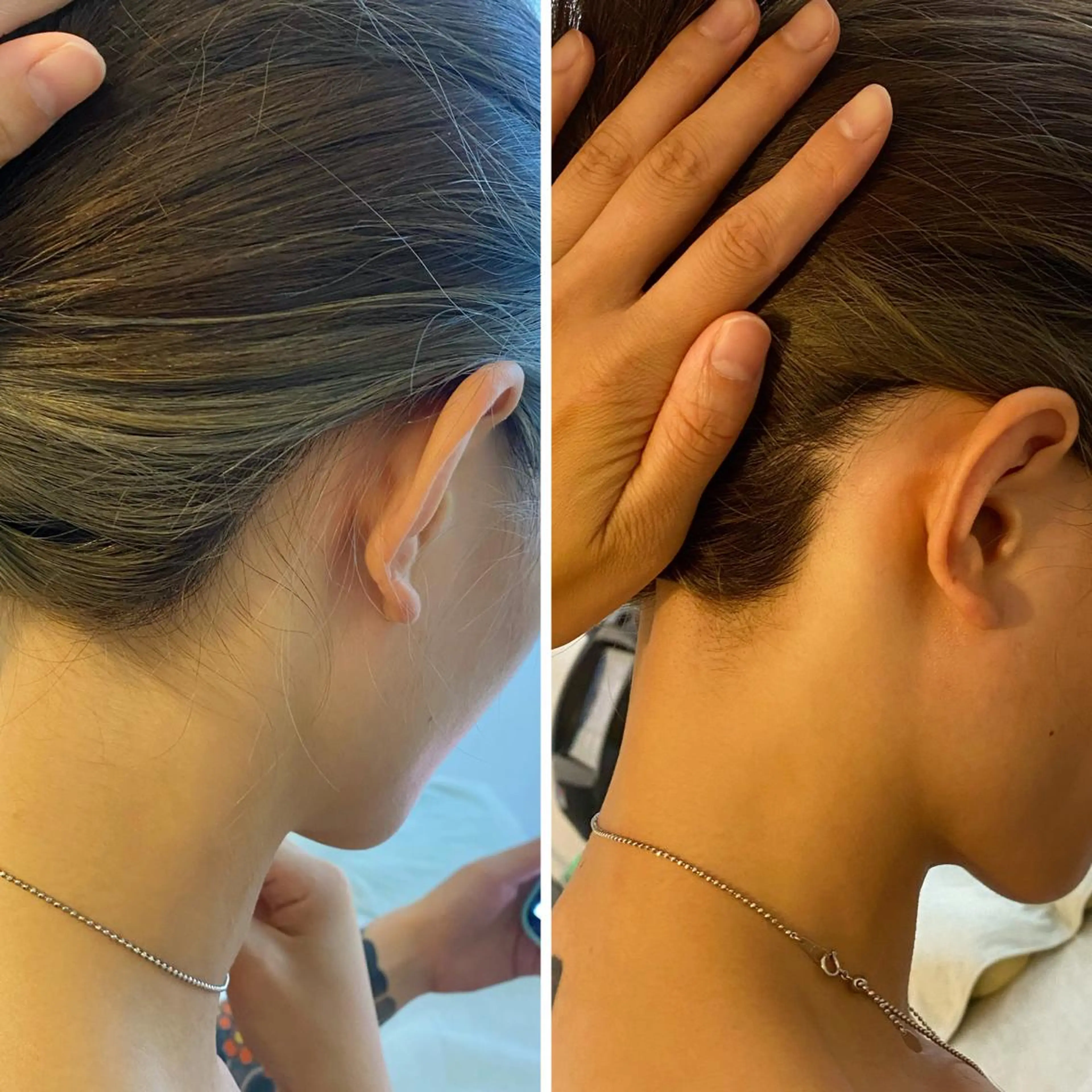 うなじ脱毛/美肌脱毛 LABELのエステ・リラクイメージ