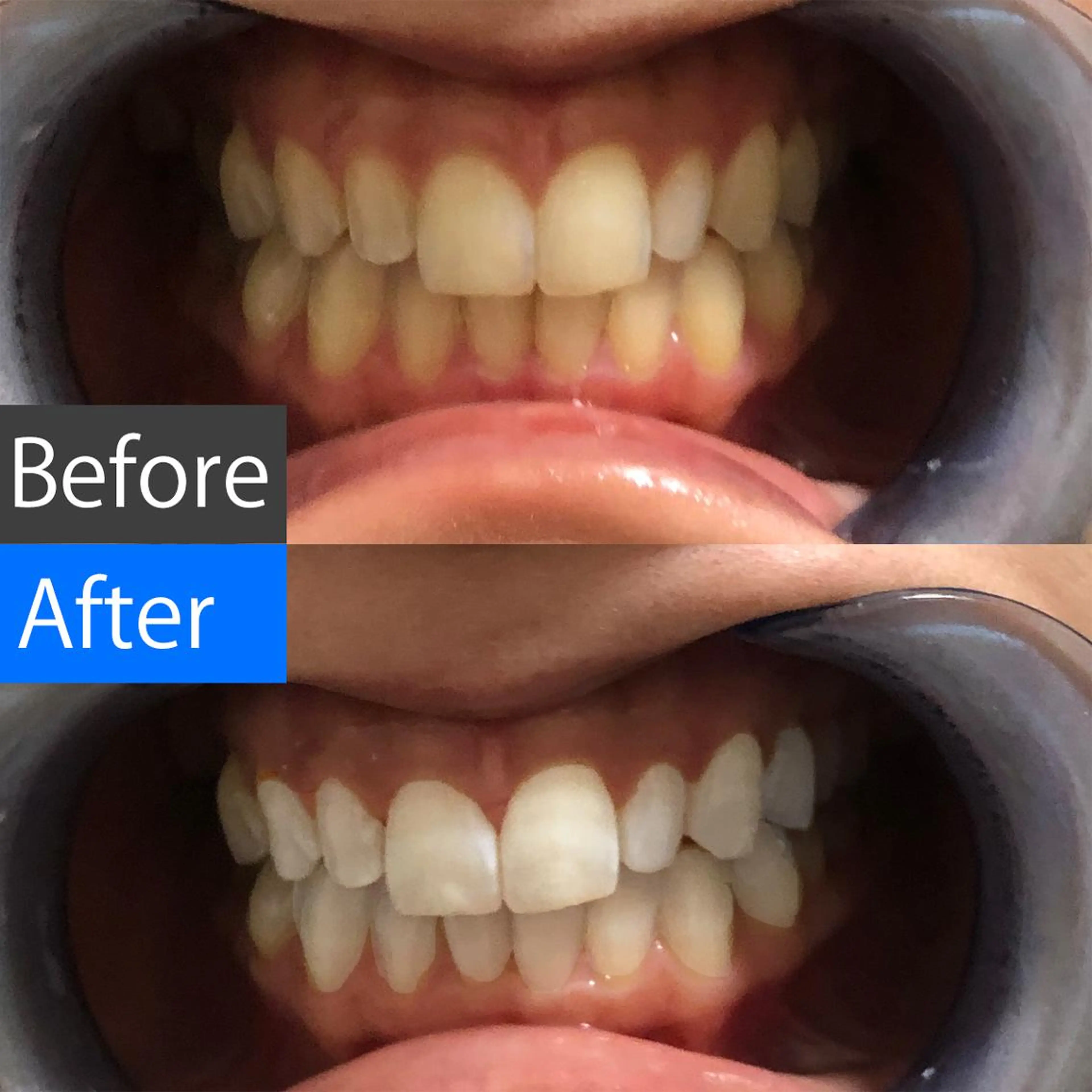 セミロング カラー パーマ ヘアアレンジ メンズ アイブロウ マツエク・マツパ ネイル キッズ 結婚式・ブライダル メンズ就活ヘア 結婚式・ブライダル オフィスネイル ブライダルネイル 中目黒 ホワイトニングサロンのその他イメージ