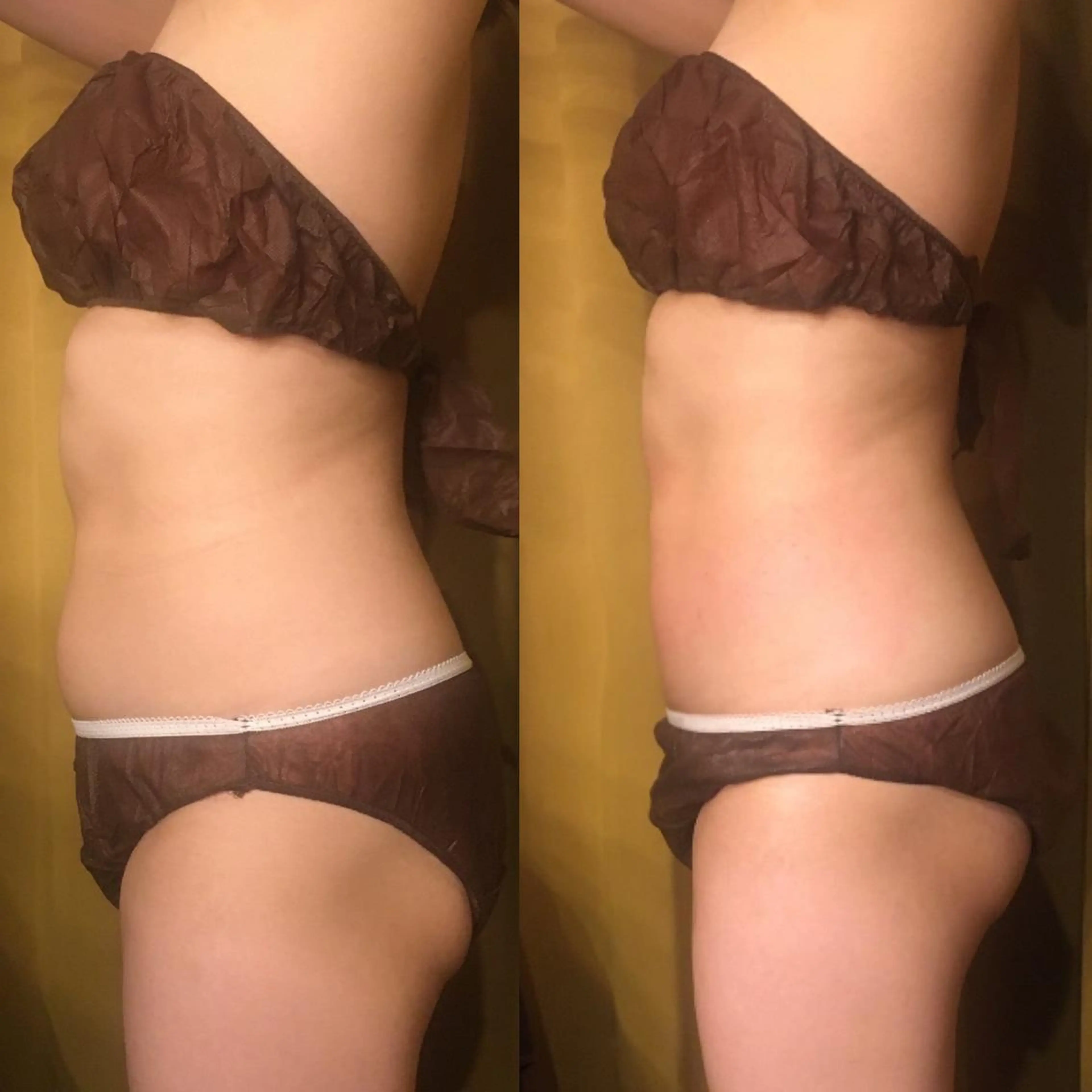 小顔やたるみに特化 💚野瀬可蓮のその他イメージ