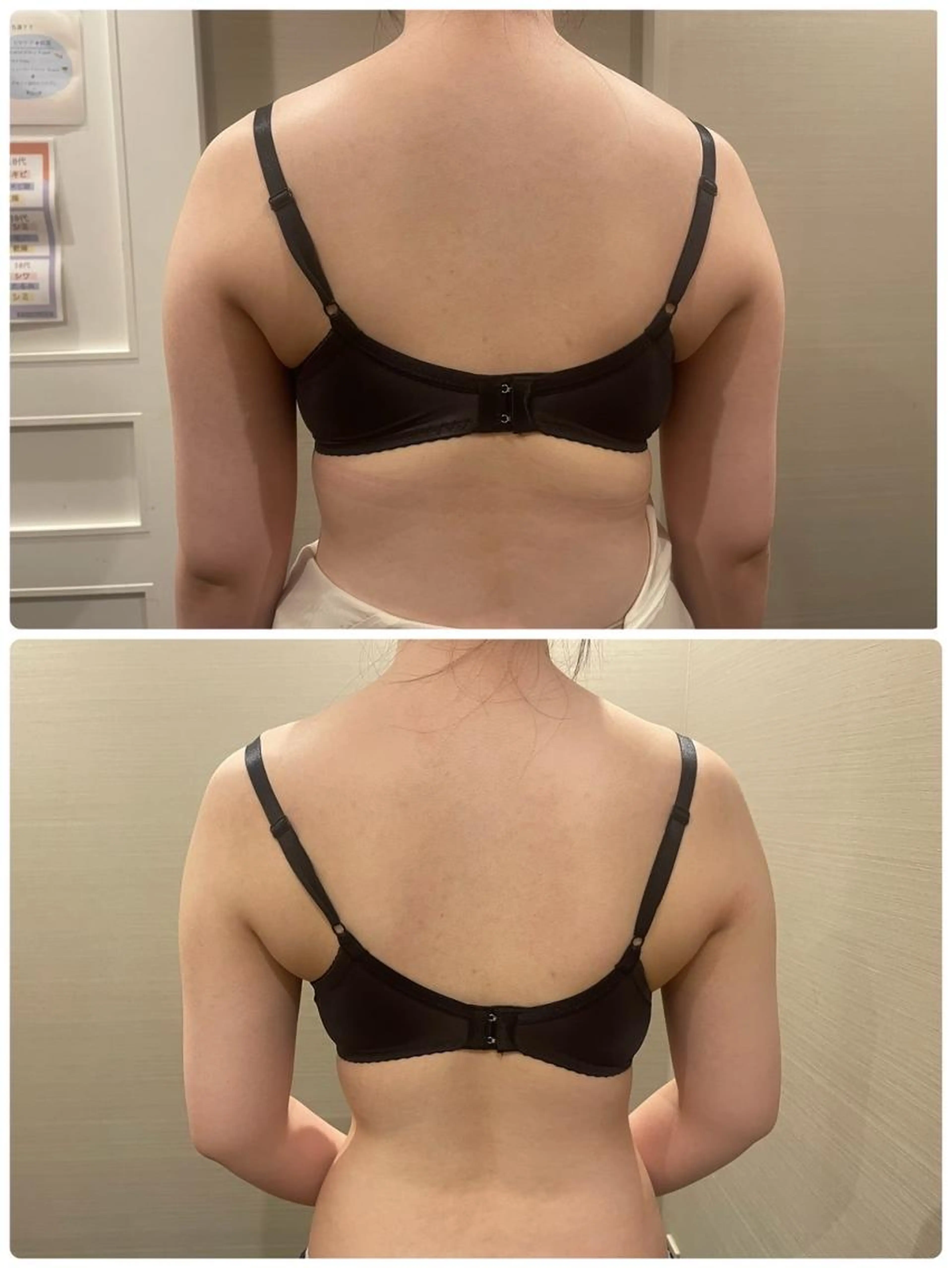 肩こりで悩まれているそこのあなた！肩こりや巻き型、姿勢のケアで綺麗なバストに導きます⭐️の写真