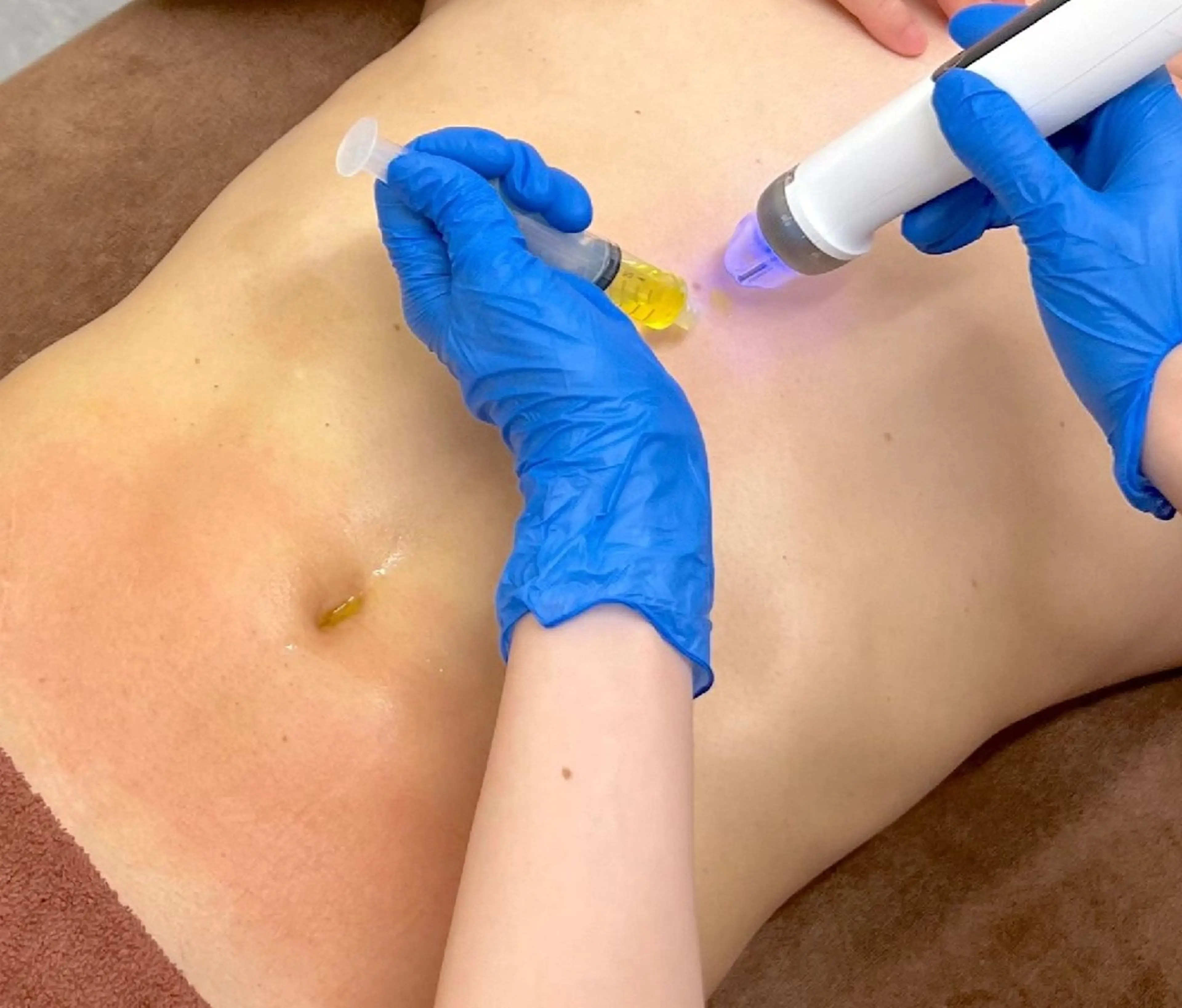 痩身小顔専門 アマテ ビューティー.Nのエステ・リラクイメージ