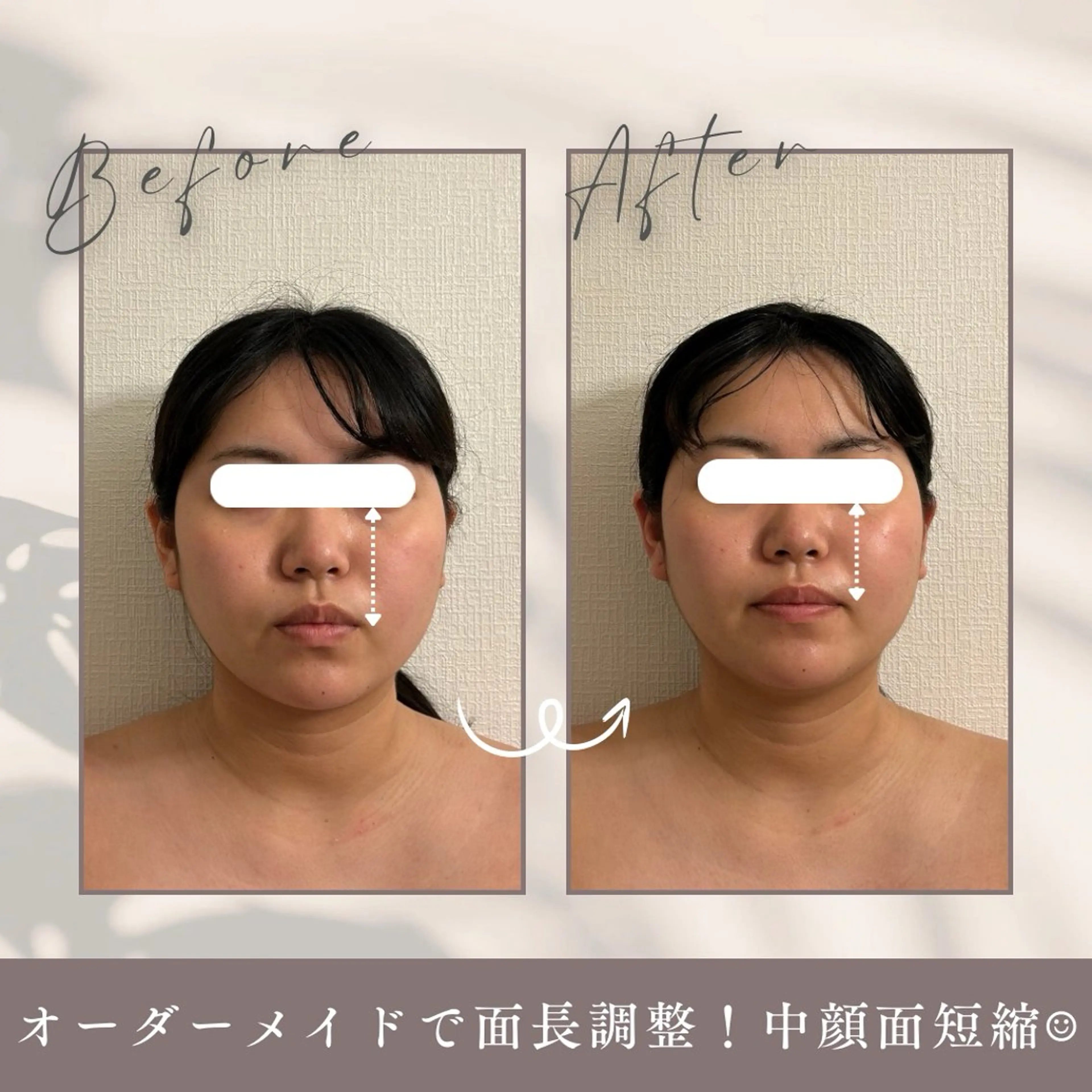 小顔セラピー LILのエステ・リラクイメージ